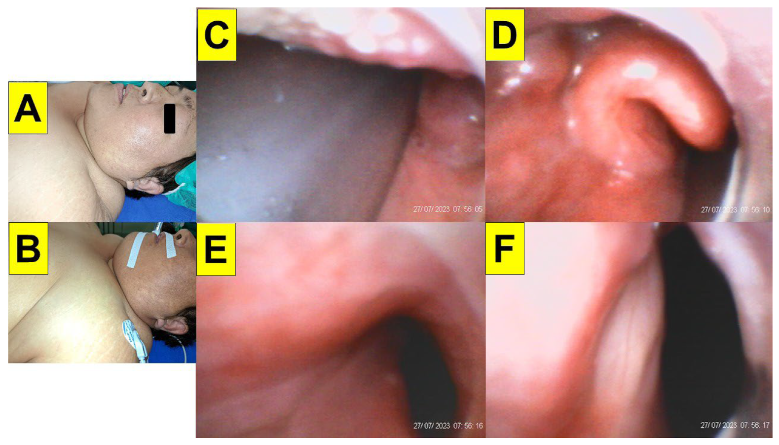 Surgeries 05 00015 g011