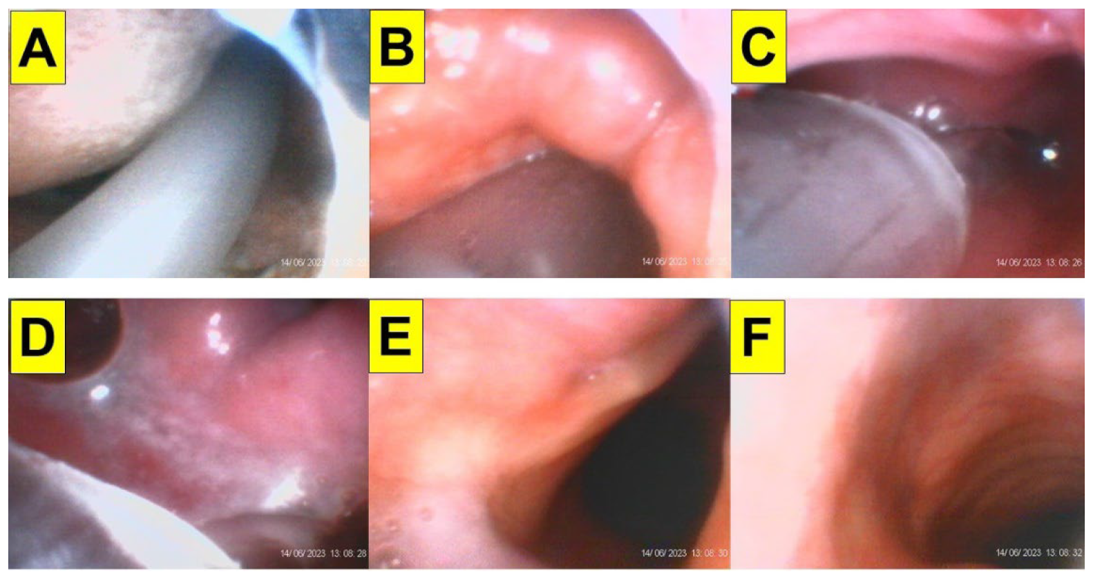 Surgeries 05 00015 g012