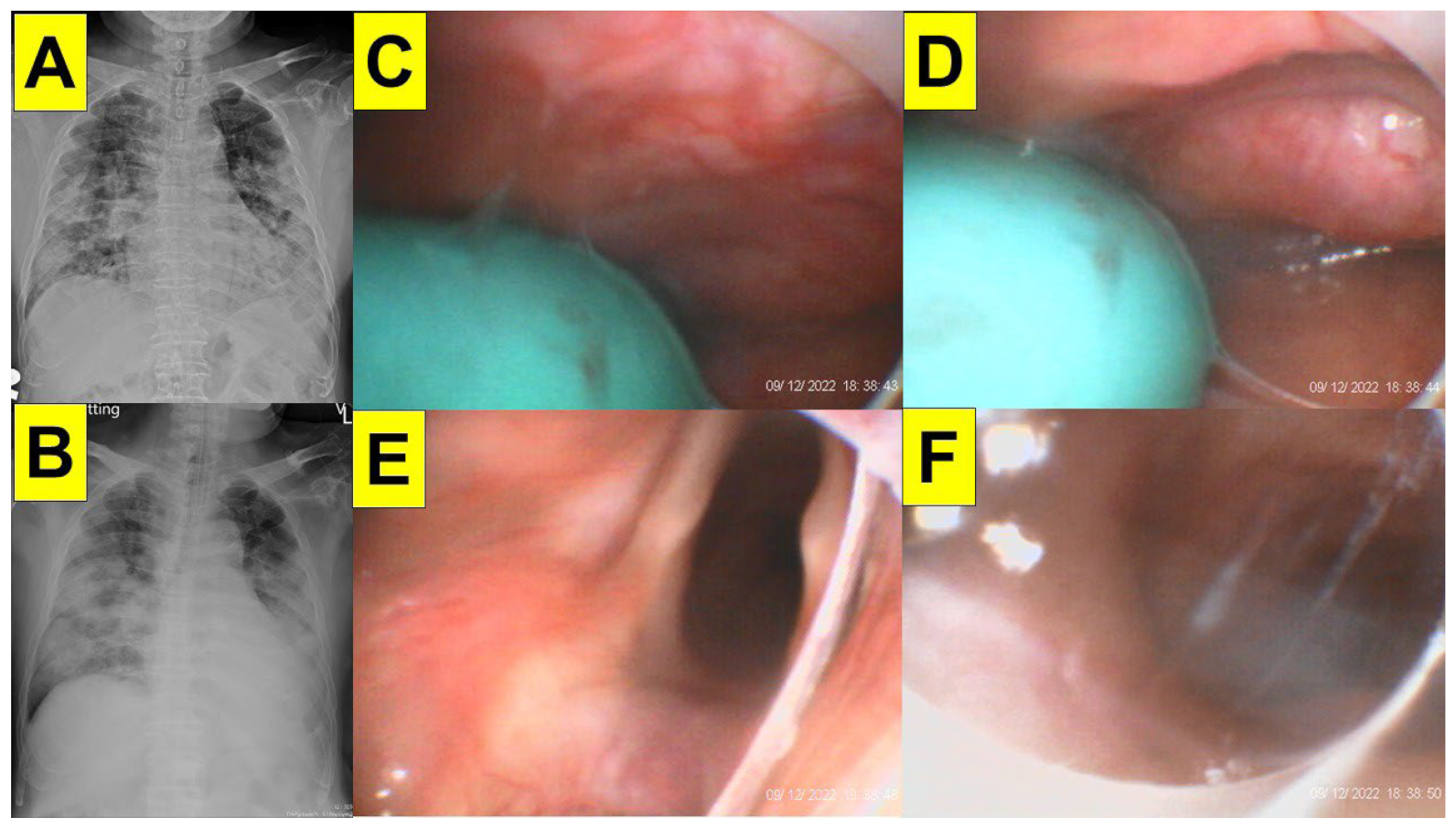 Surgeries 05 00015 g013