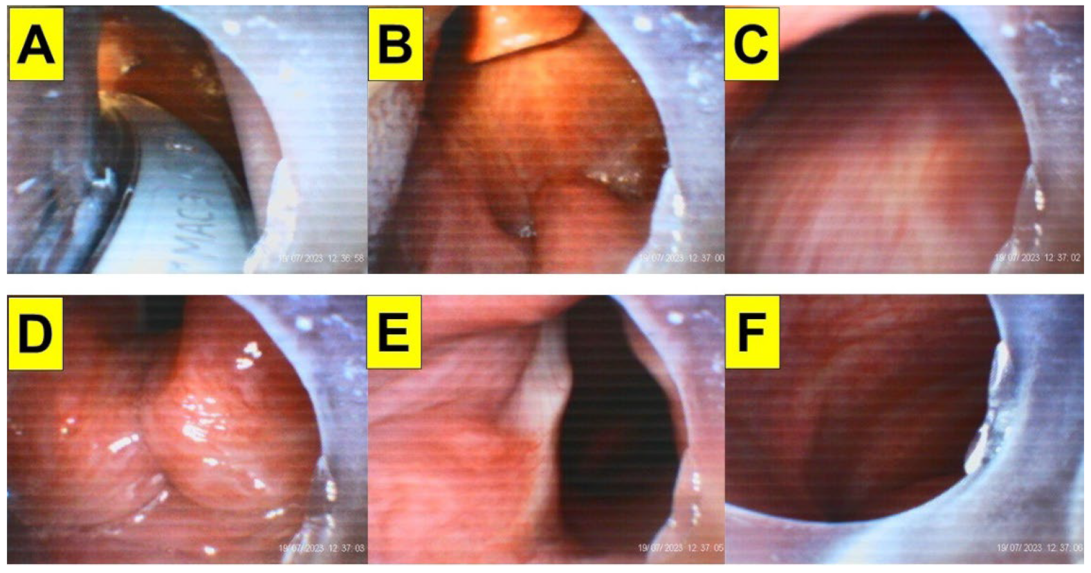 Surgeries 05 00015 g014