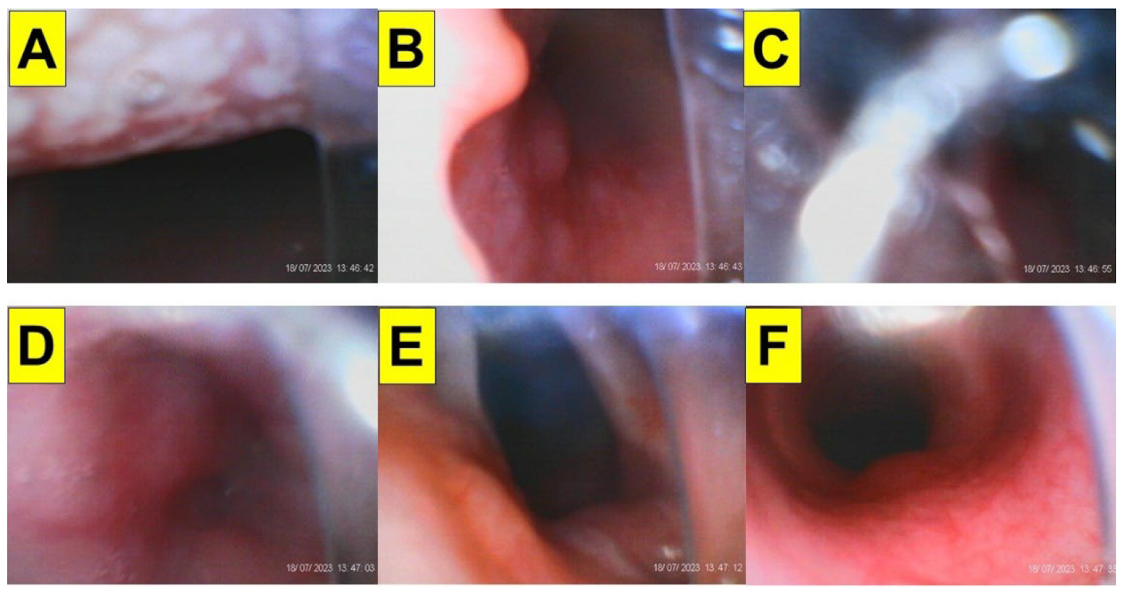 Surgeries 05 00015 g015