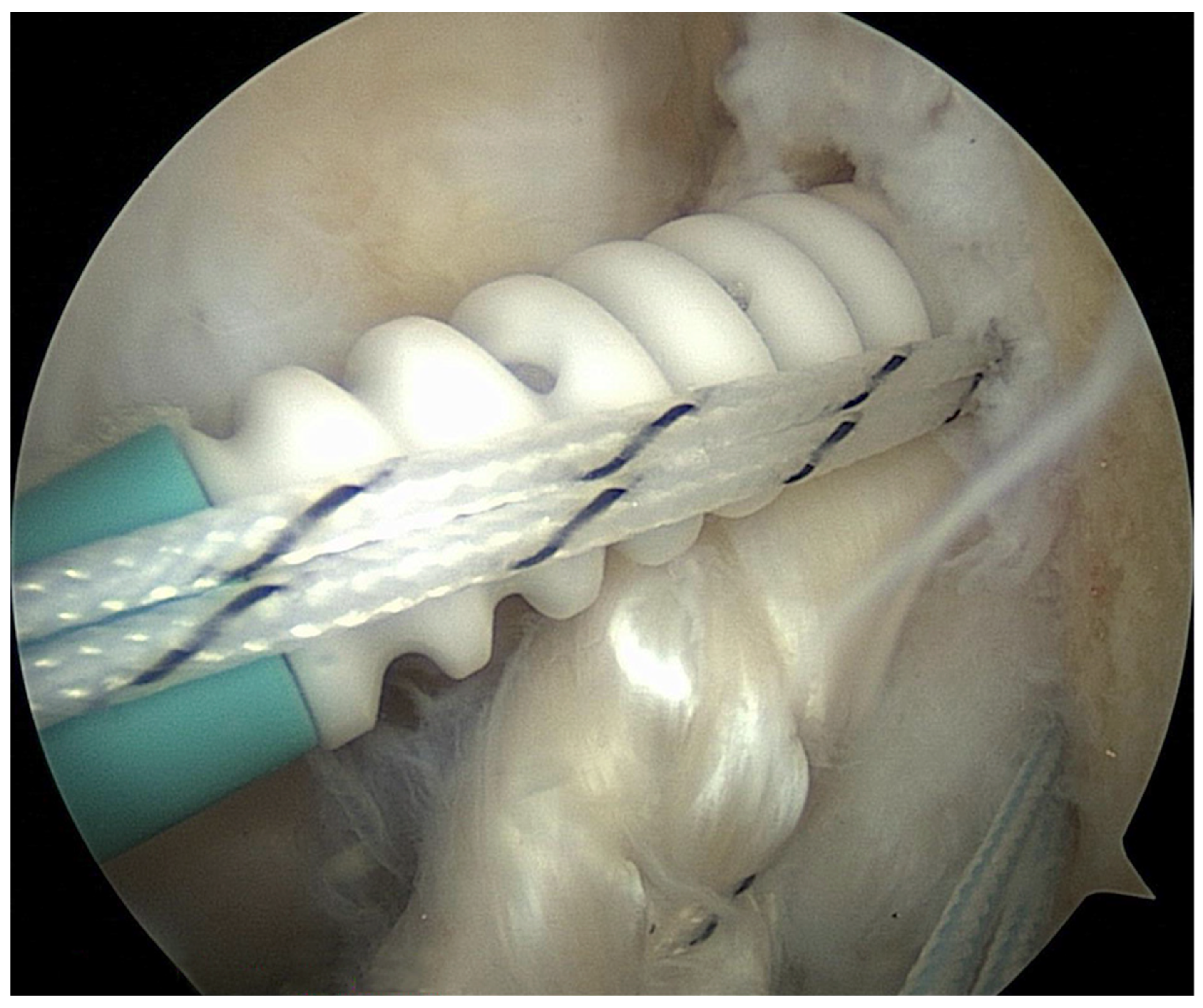 Surgeries 05 00022 g002