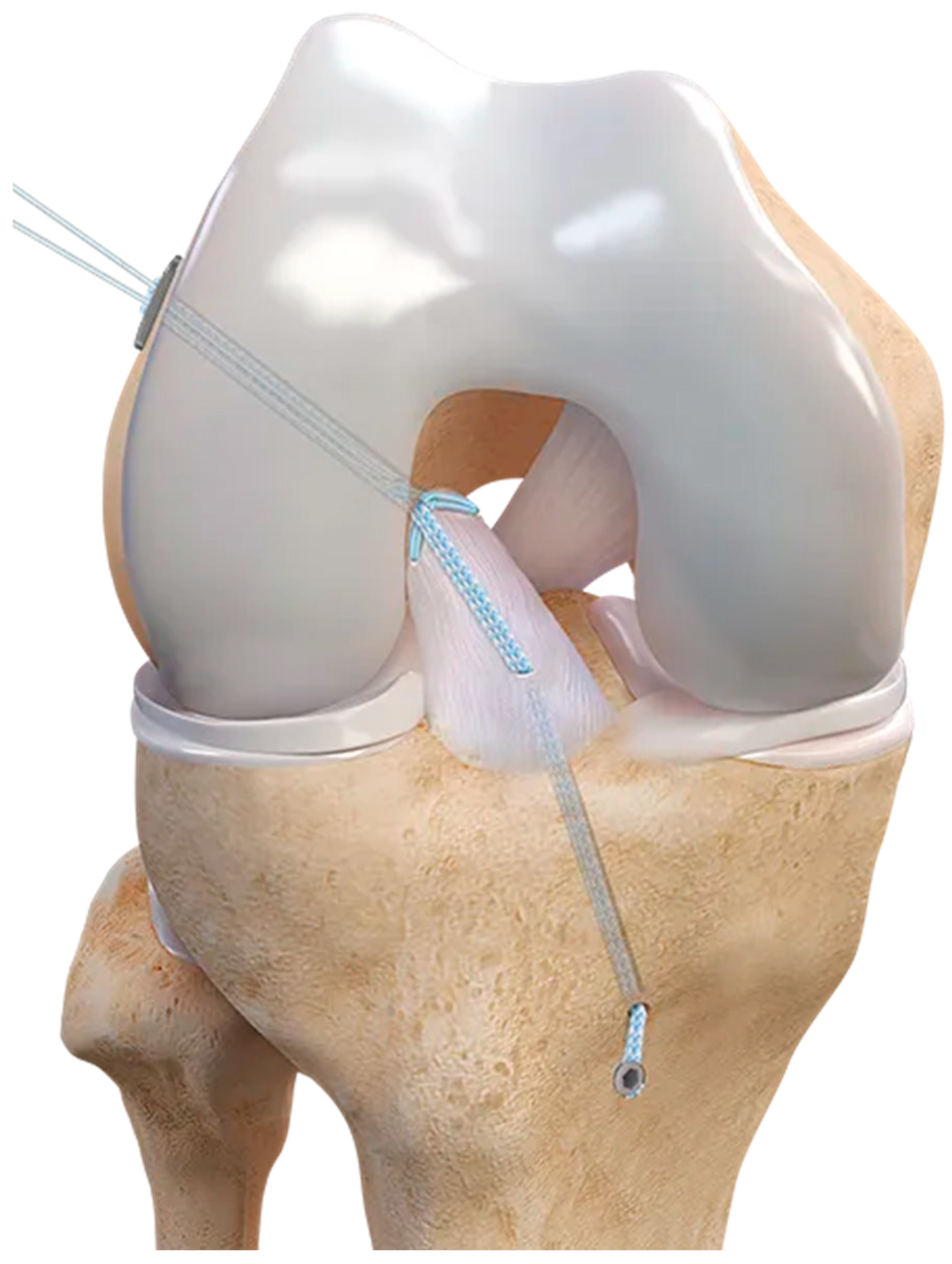 Surgeries 05 00022 g005