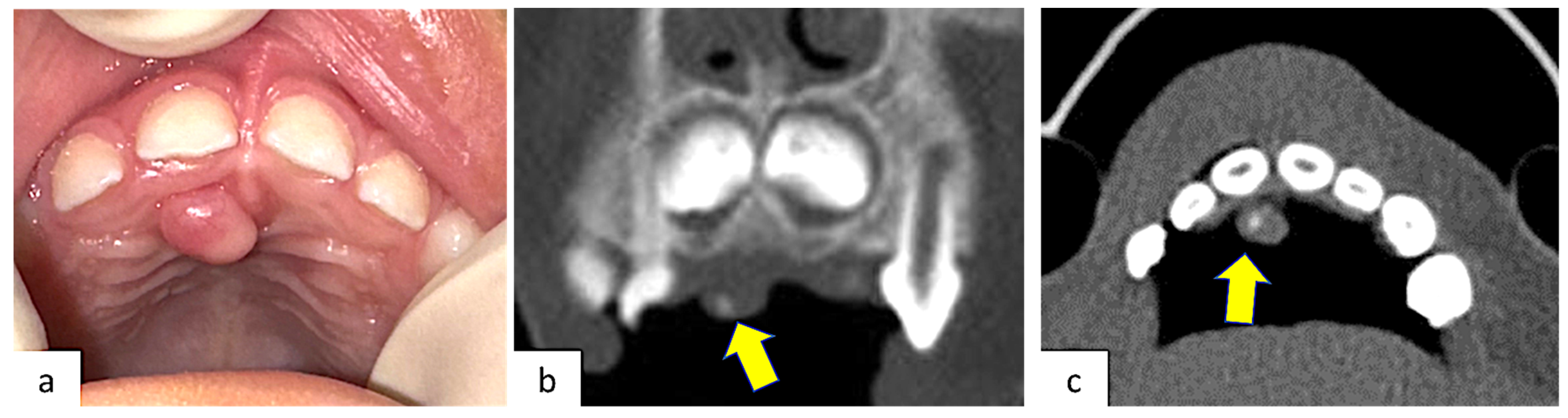 Surgeries 05 00032 g001