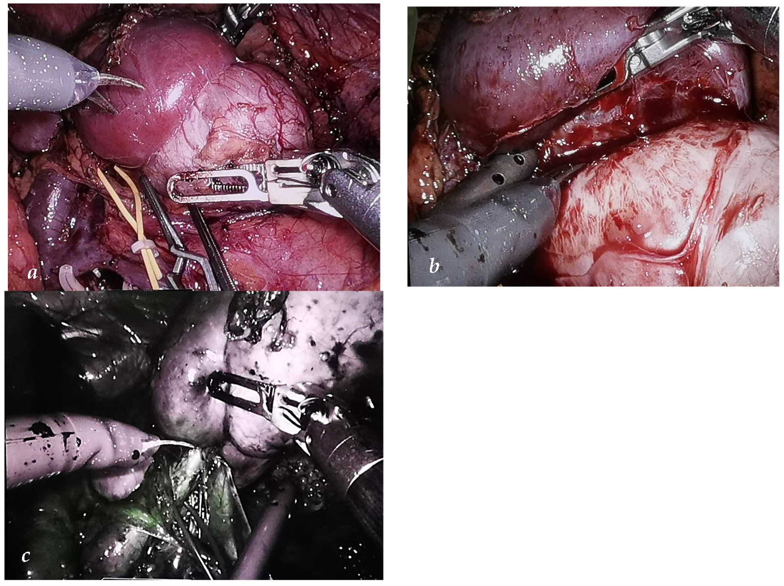 Surgeries 05 00034 g004