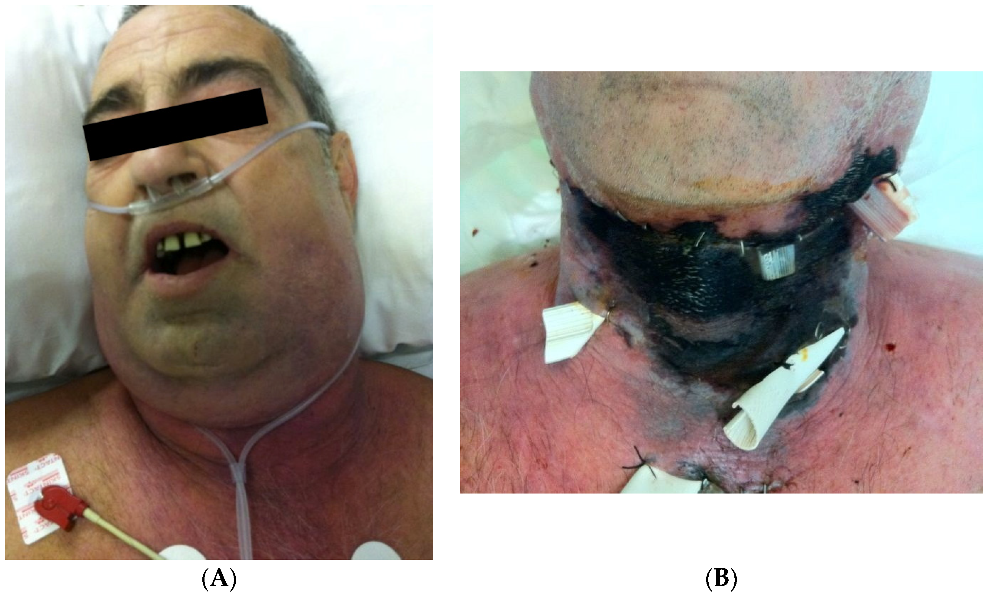 Surgeries 05 00042 g001