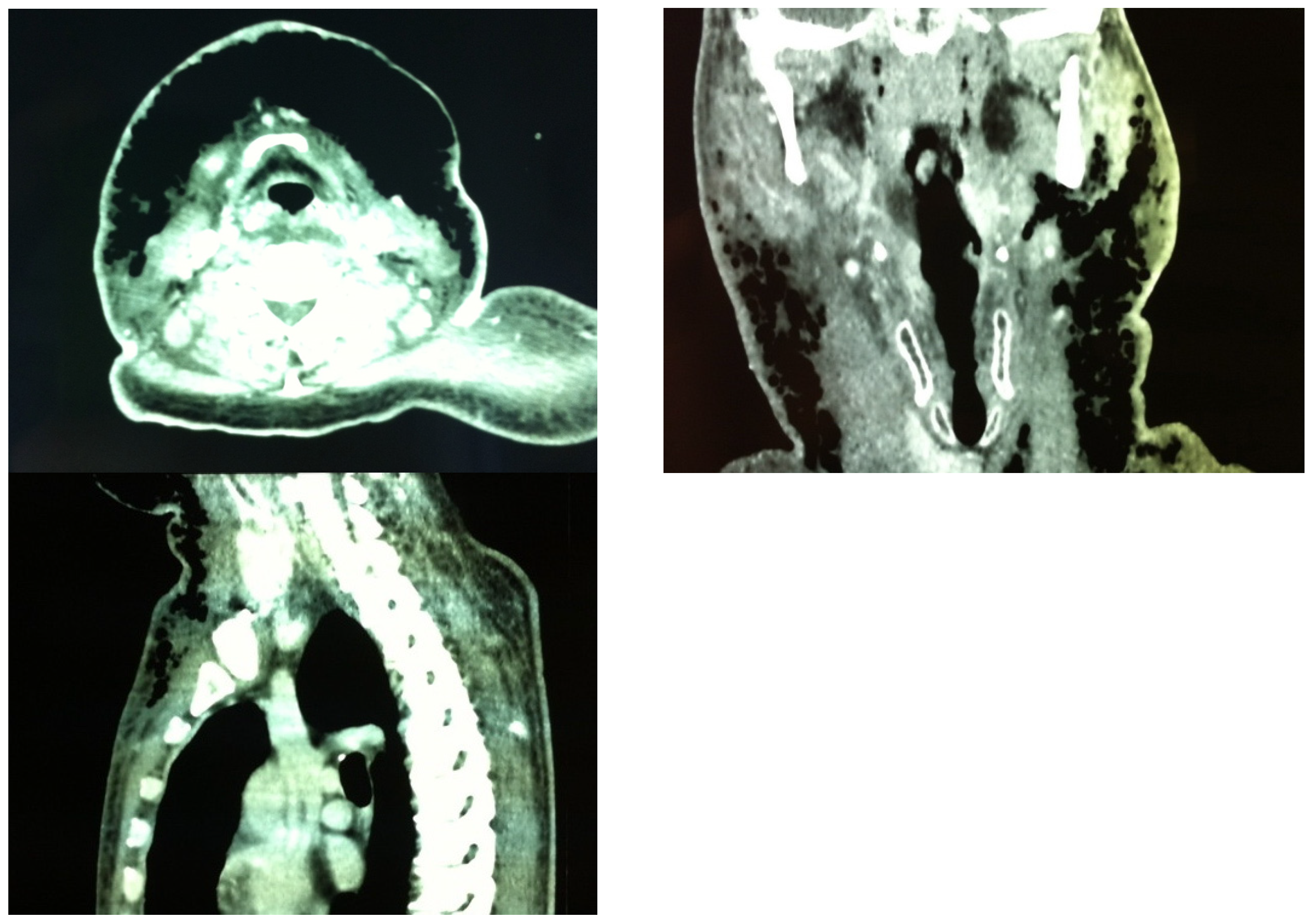 Surgeries 05 00042 g002