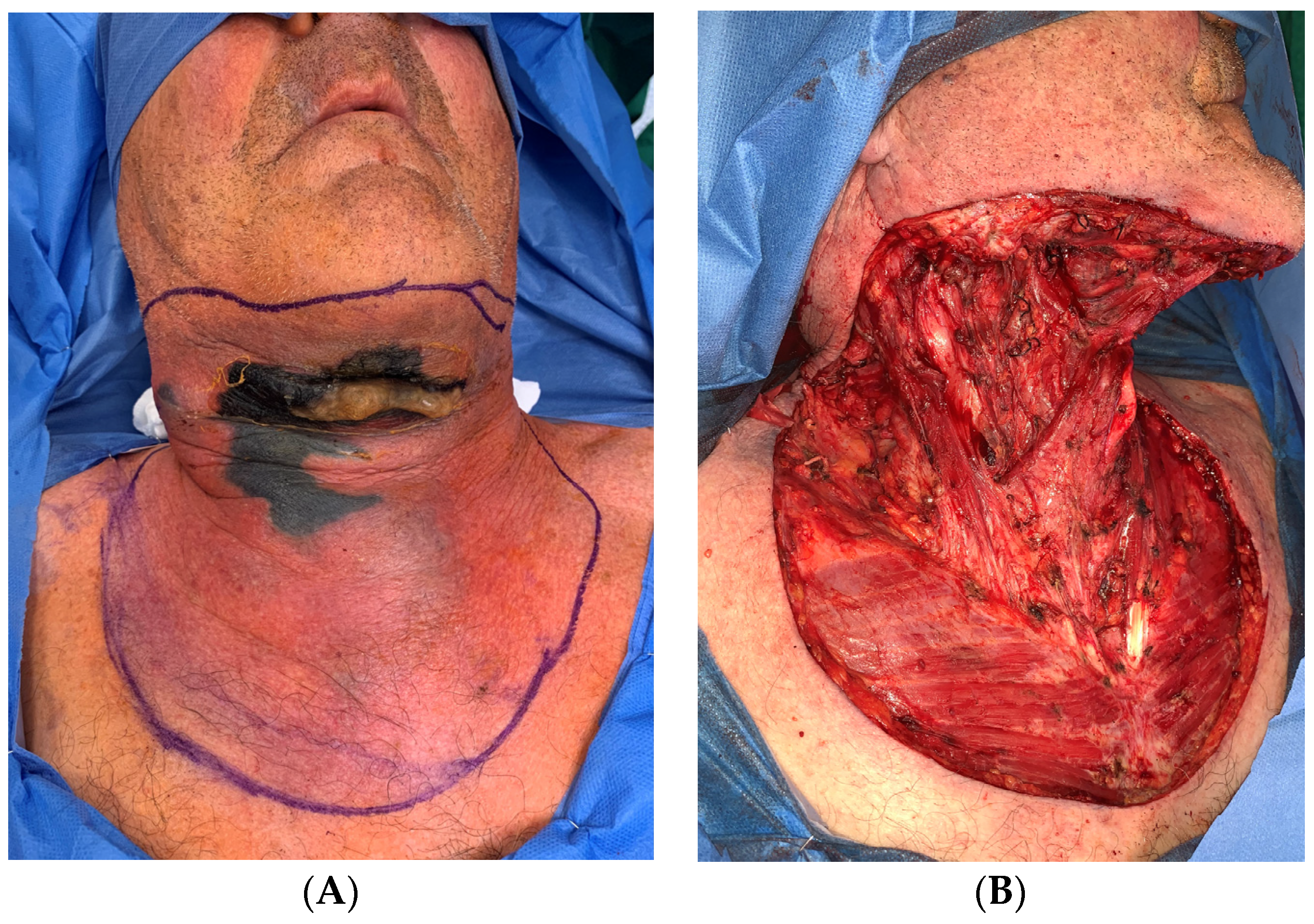 Surgeries 05 00042 g004