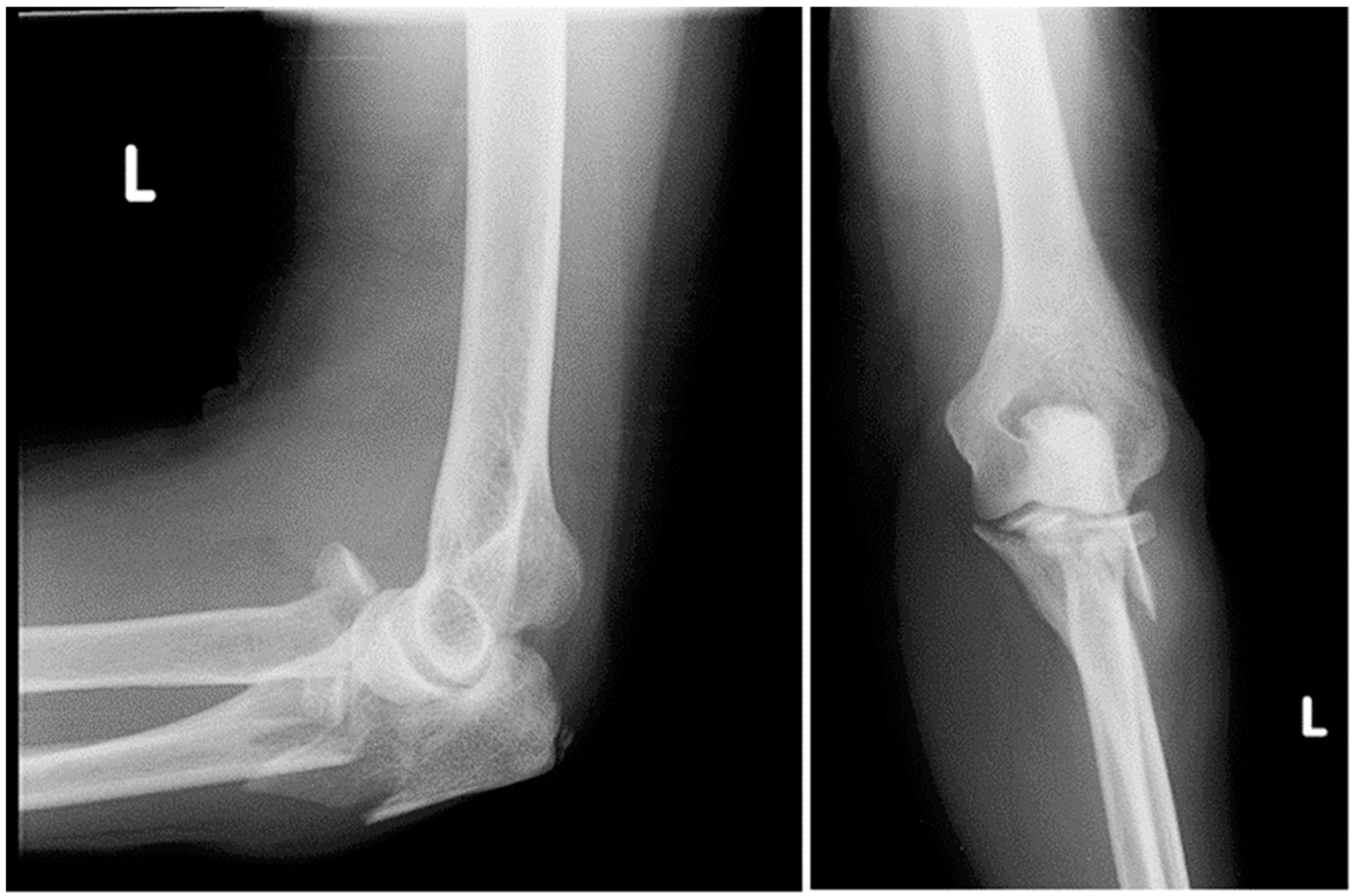 Surgeries 05 00048 g001