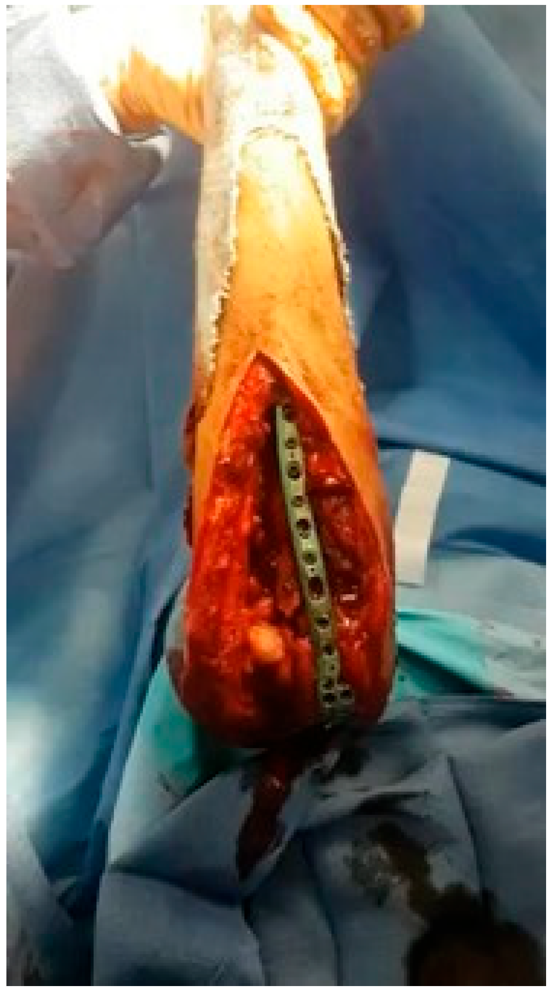 Surgeries 05 00048 g003