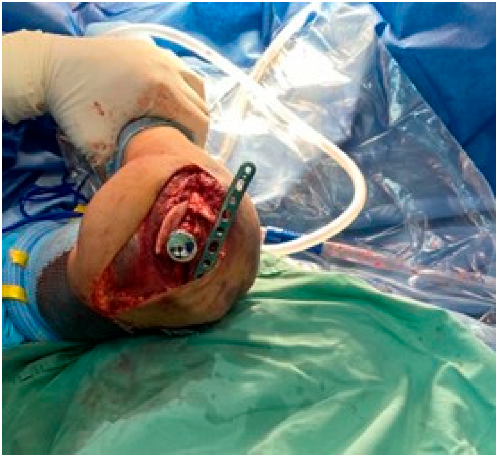 Surgeries 05 00048 g004