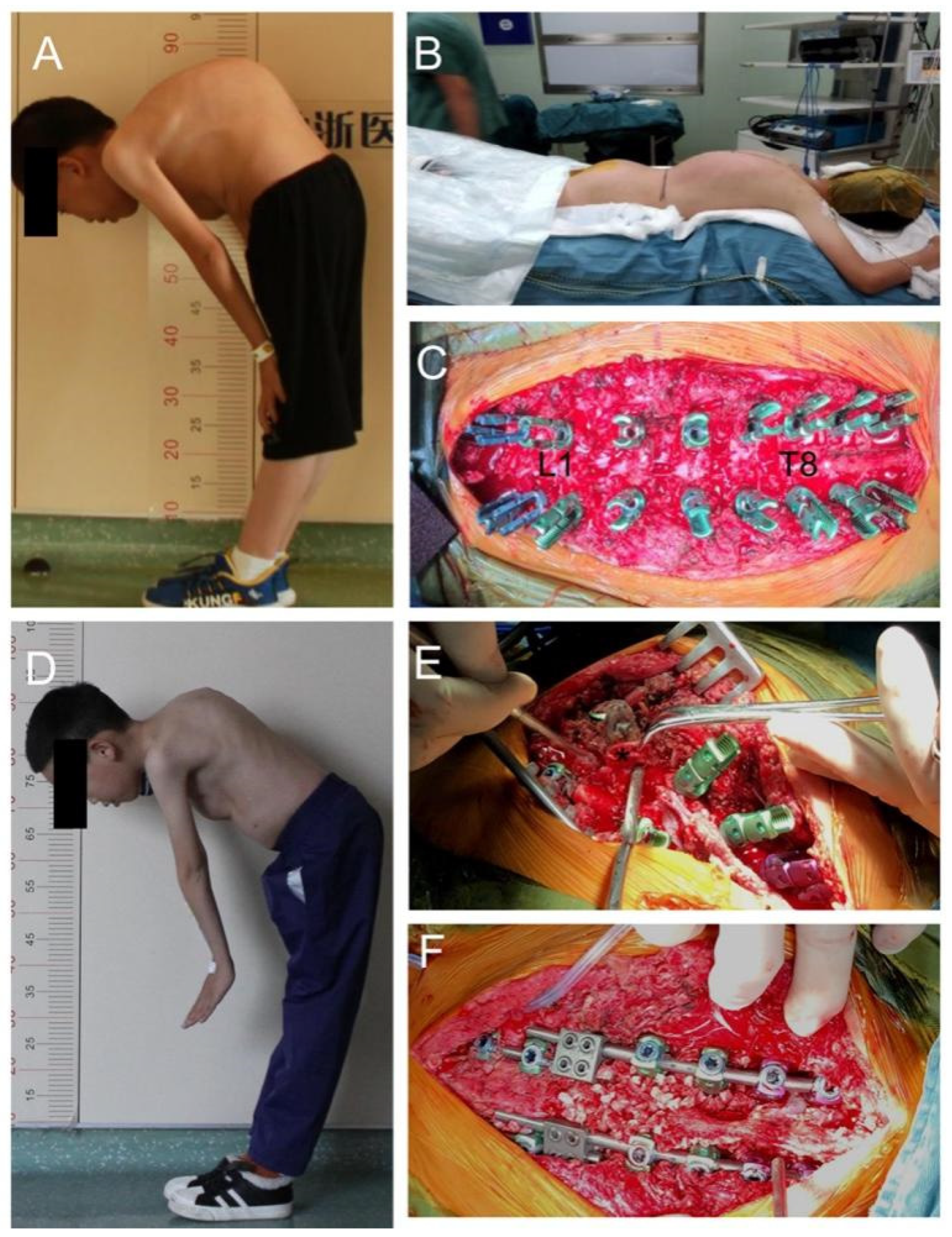 Surgeries 05 00049 g002