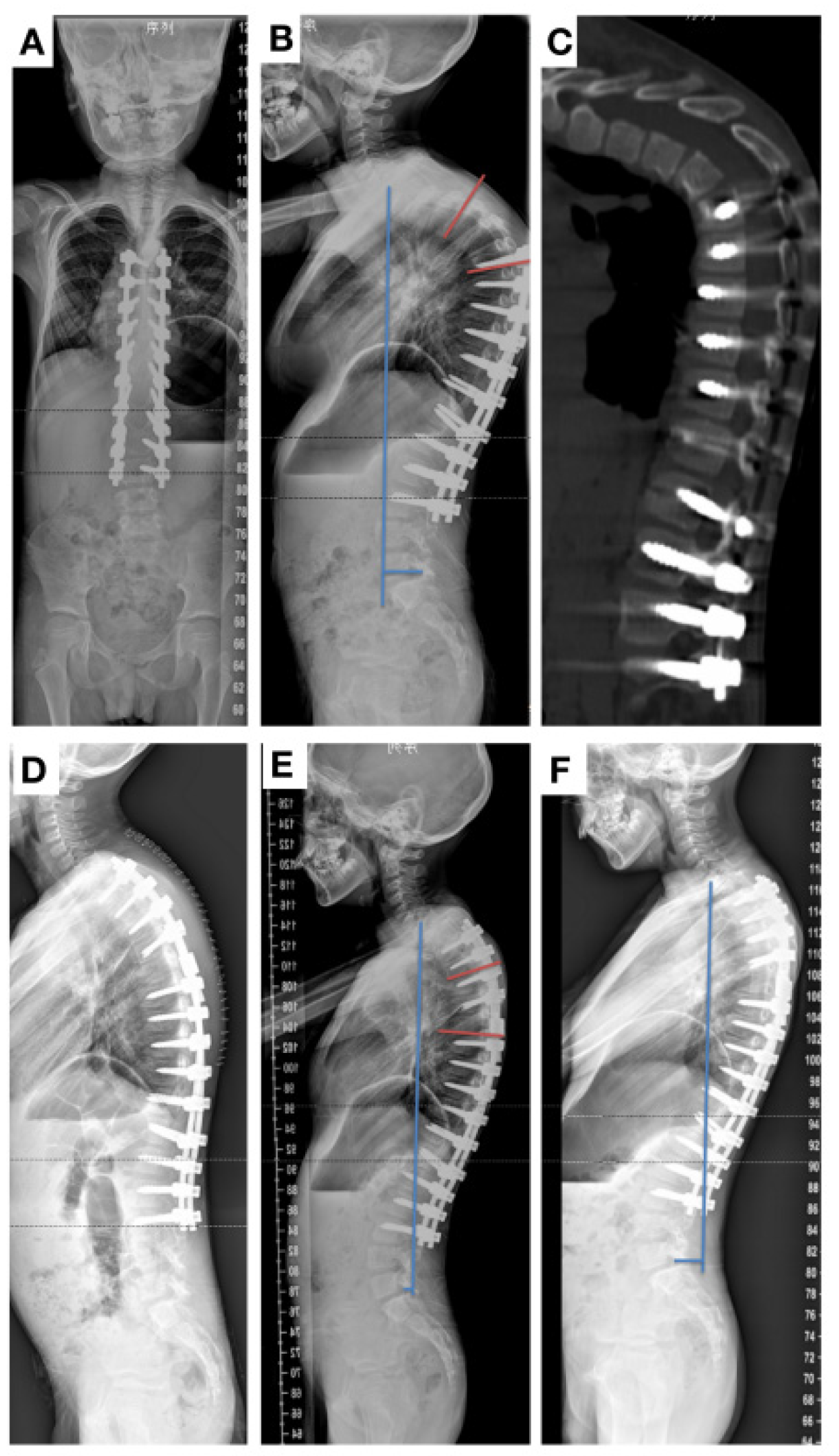 Surgeries 05 00049 g003
