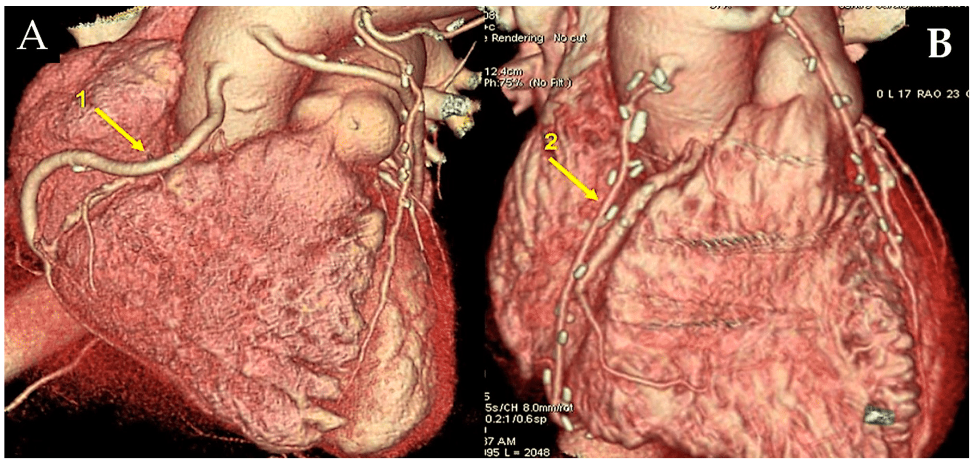 Surgeries 06 00006 g001