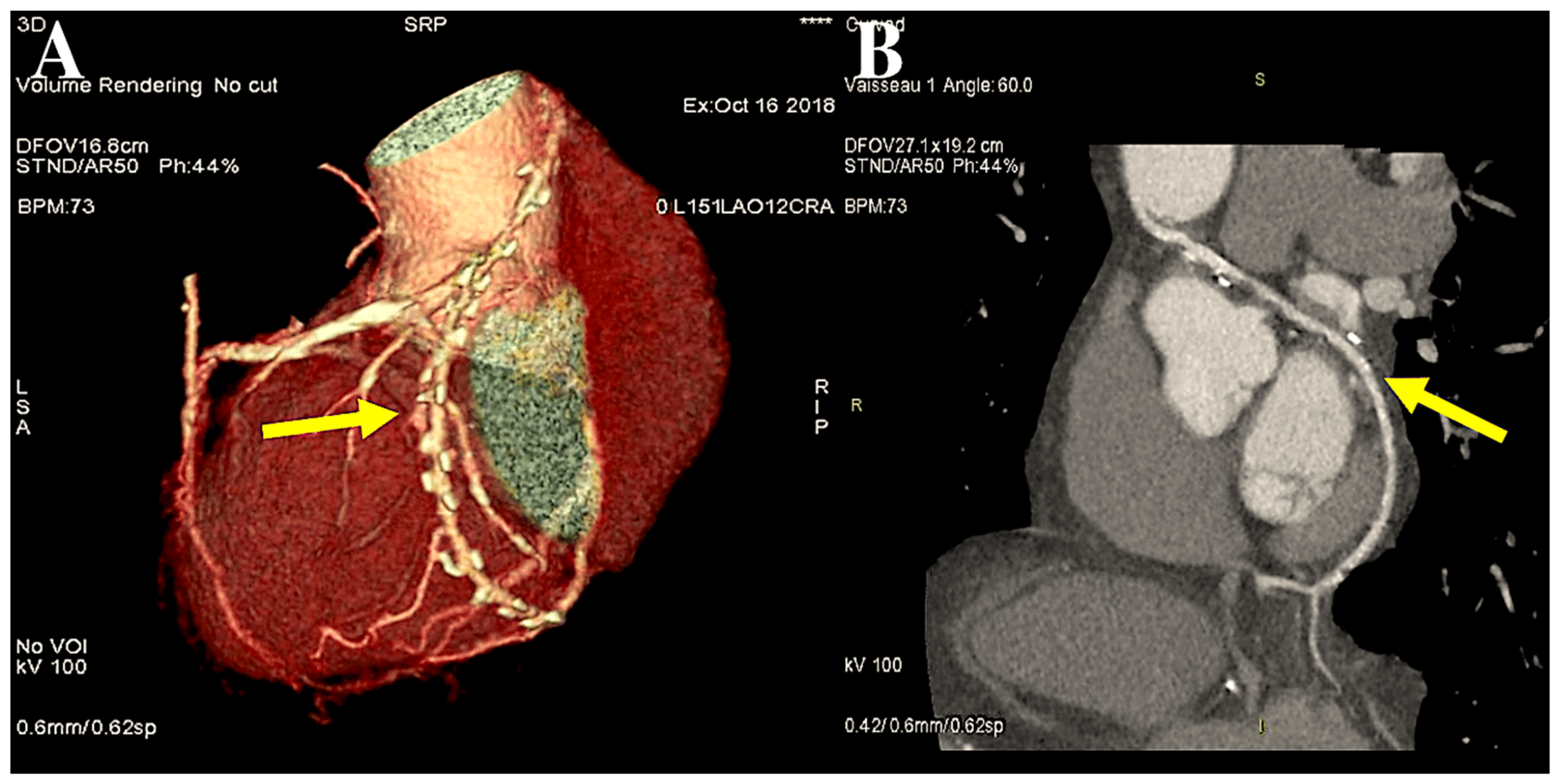 Surgeries 06 00006 g002
