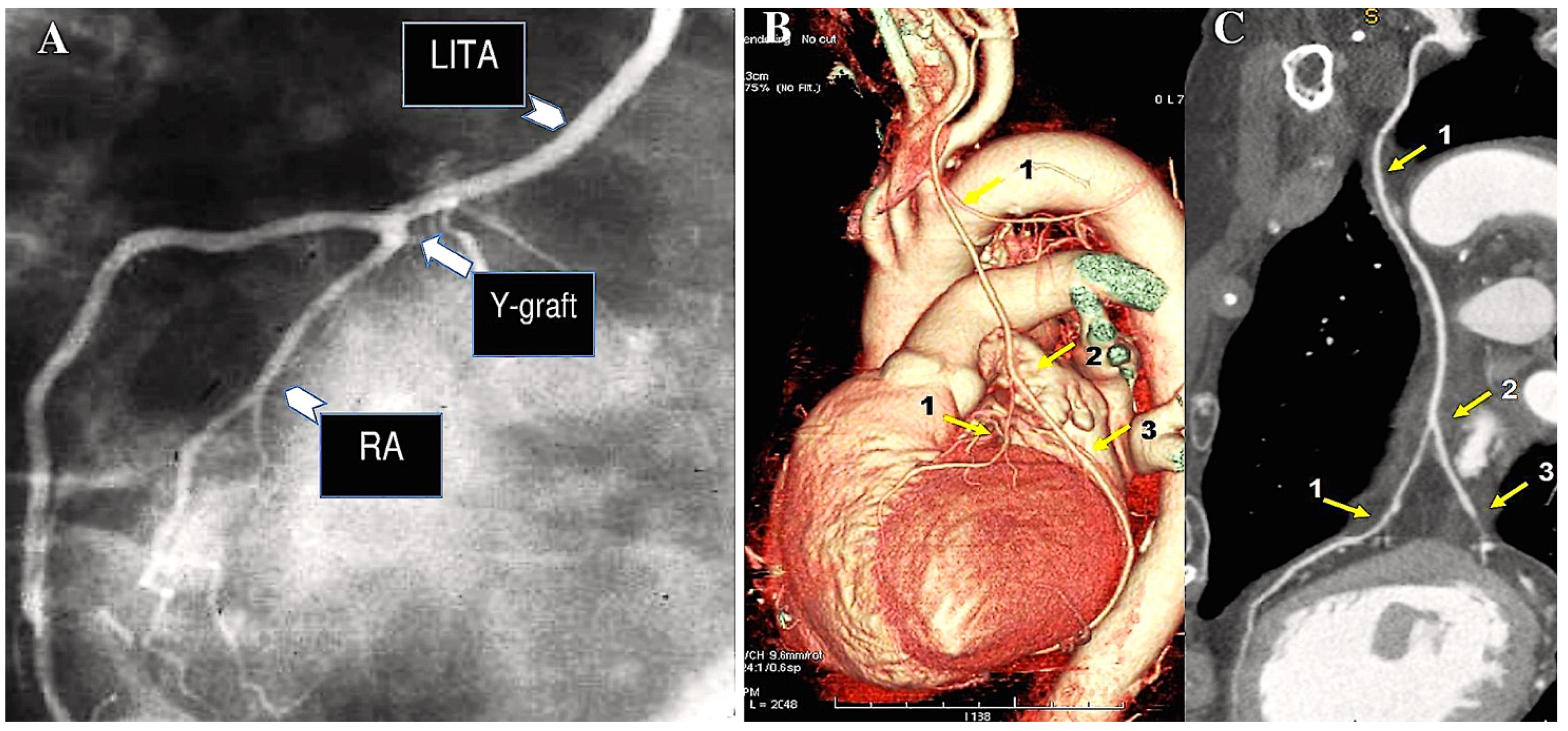 Surgeries 06 00006 g004