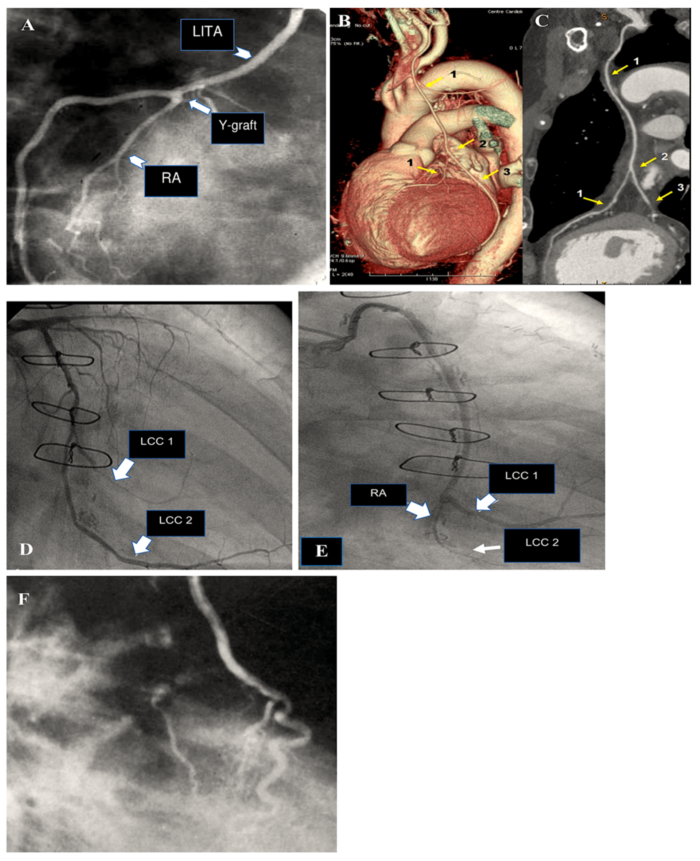 Surgeries 06 00006 g005