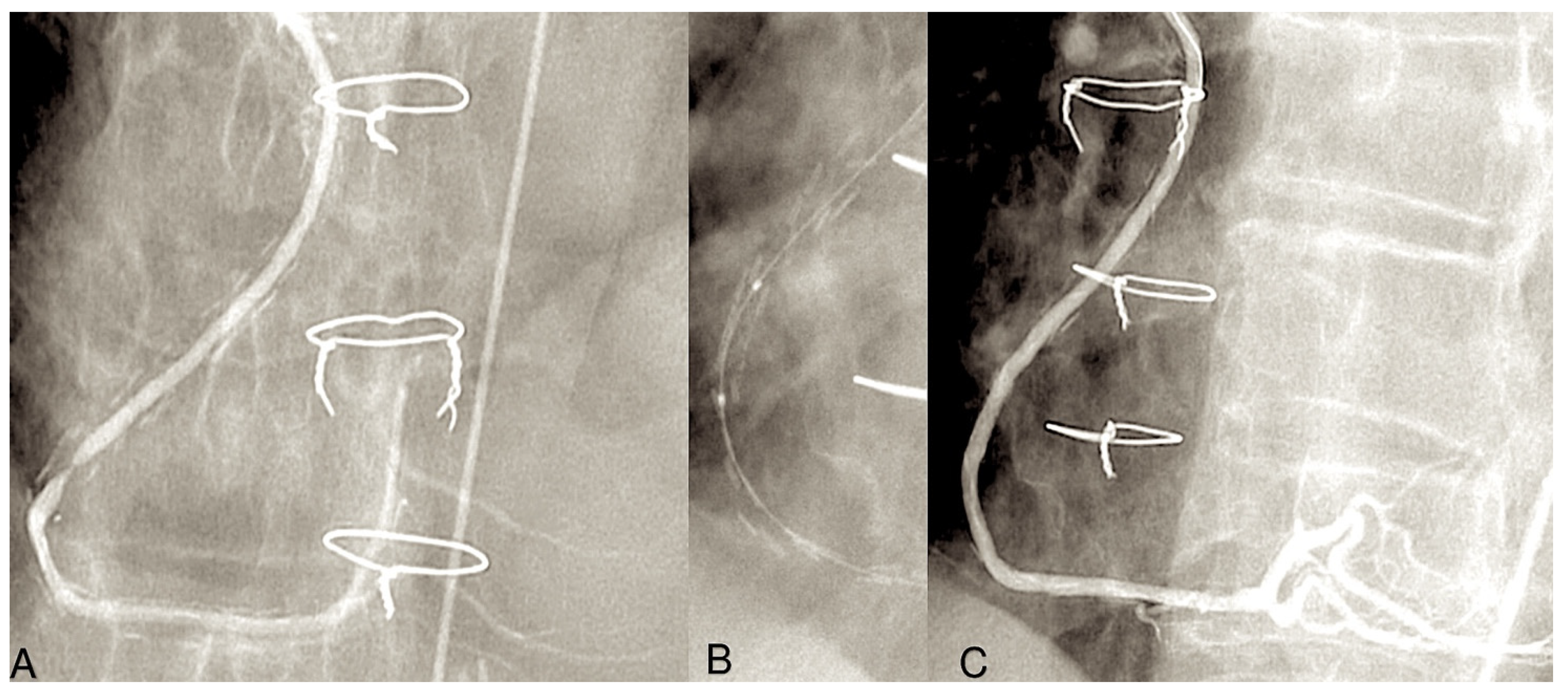 Surgeries 06 00006 g006