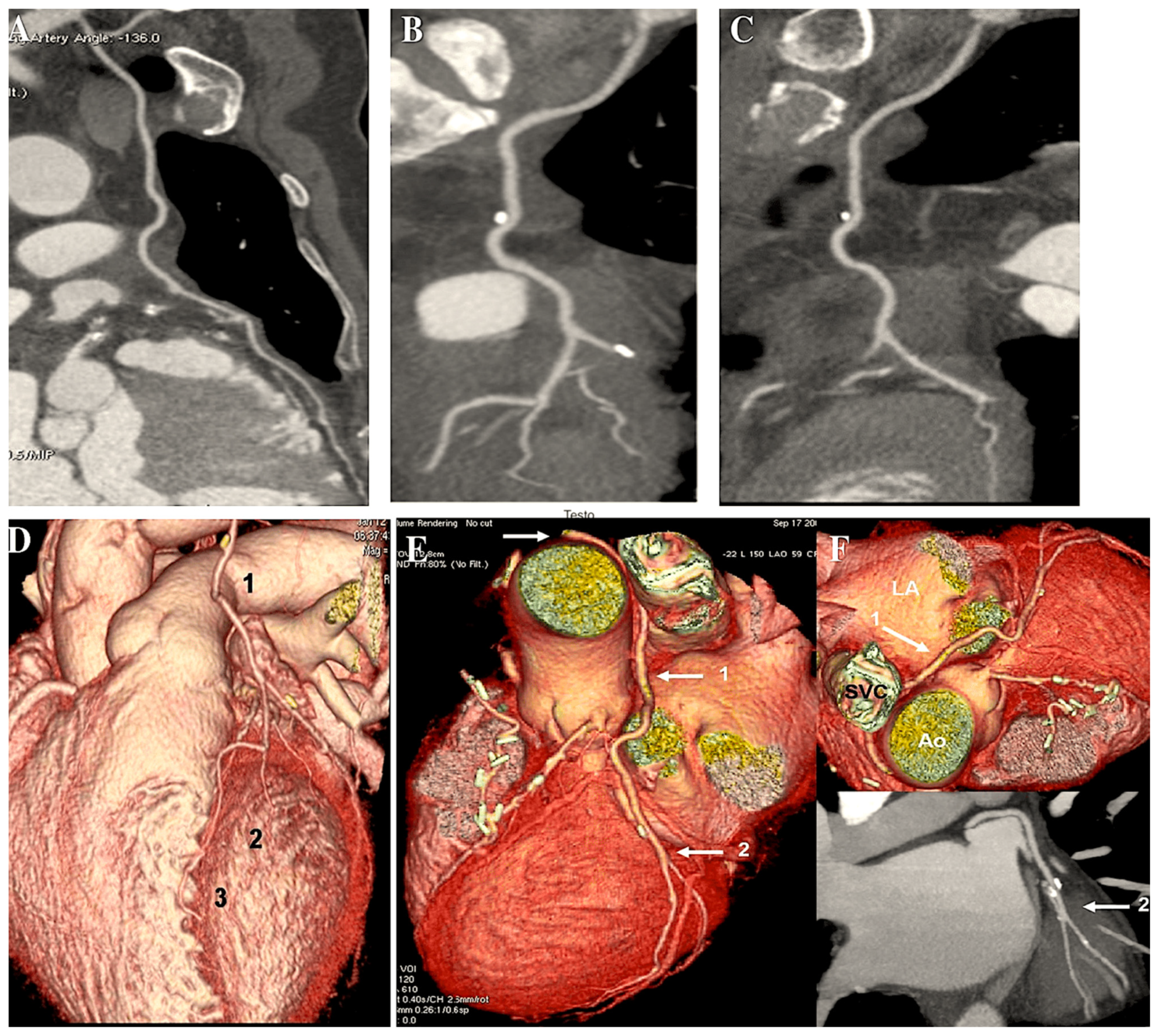 Surgeries 06 00006 g007