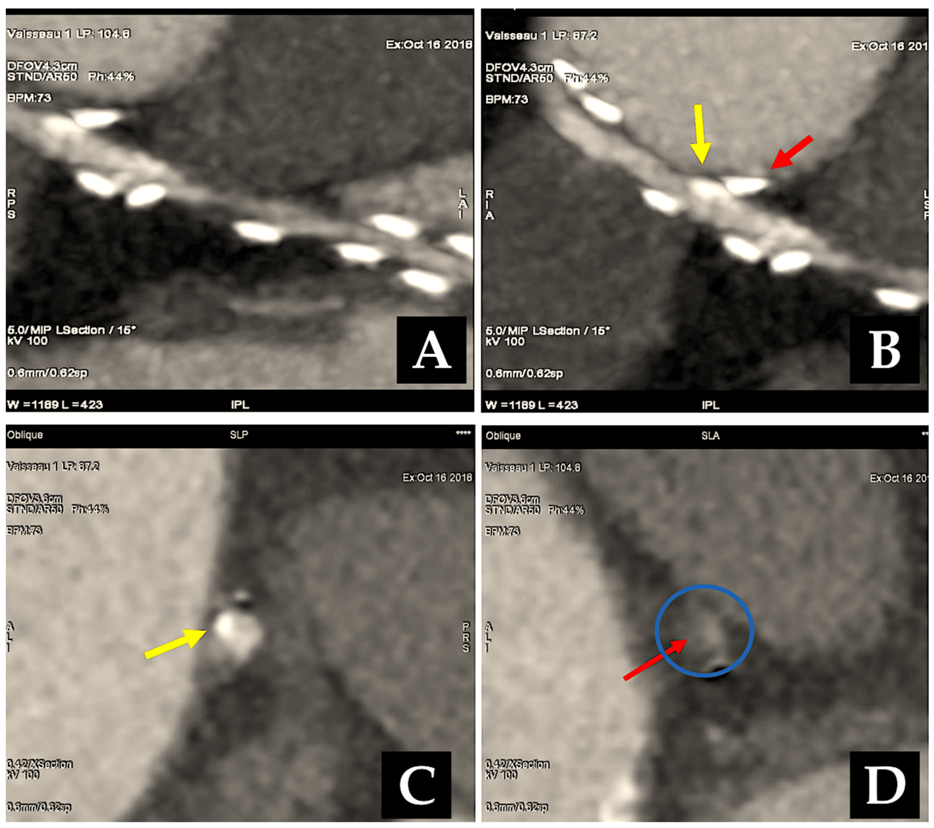 Surgeries 06 00006 g008