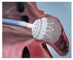 Surgeries 06 00015 i004