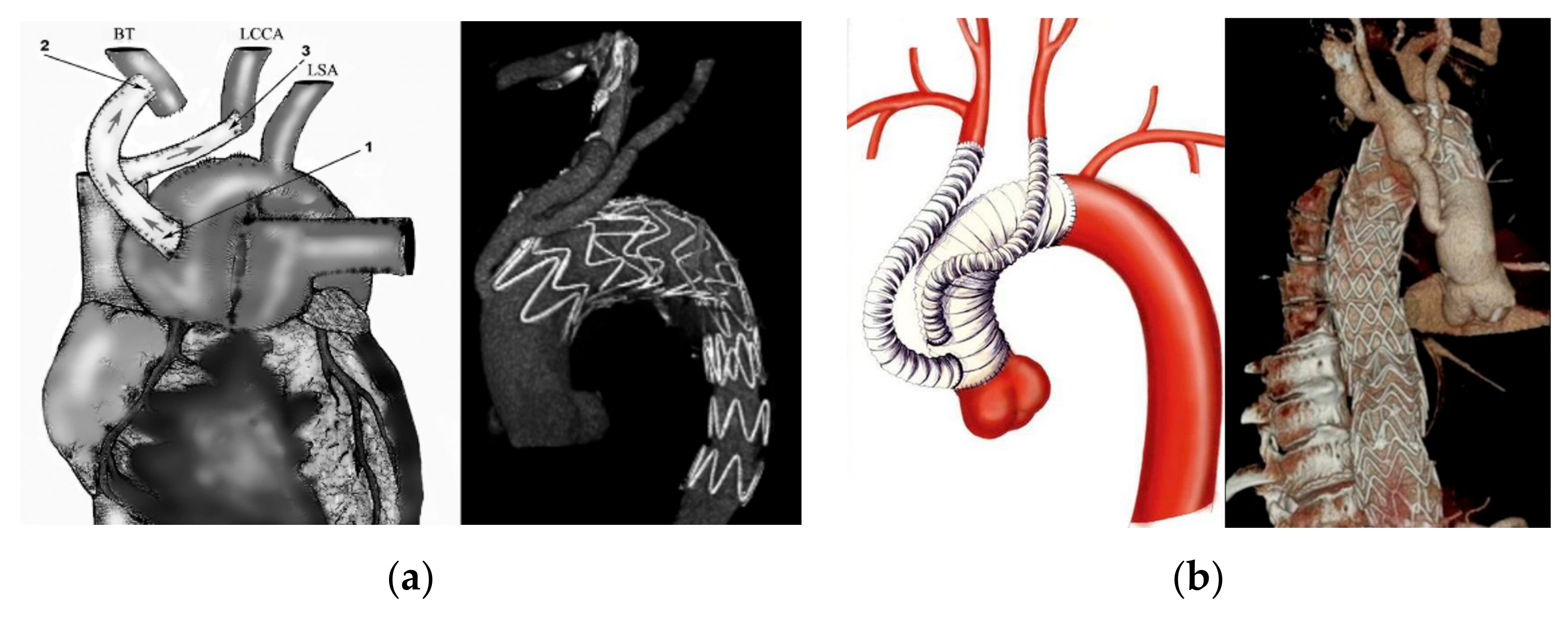 Surgeries 06 00027 g001