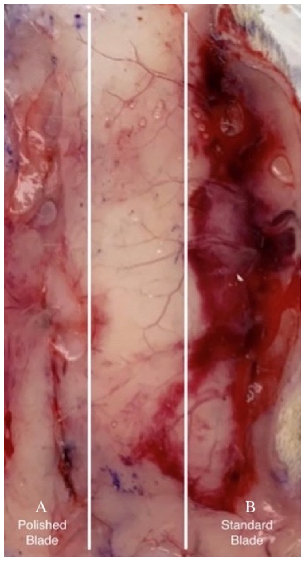 Surgeries 06 00030 g003