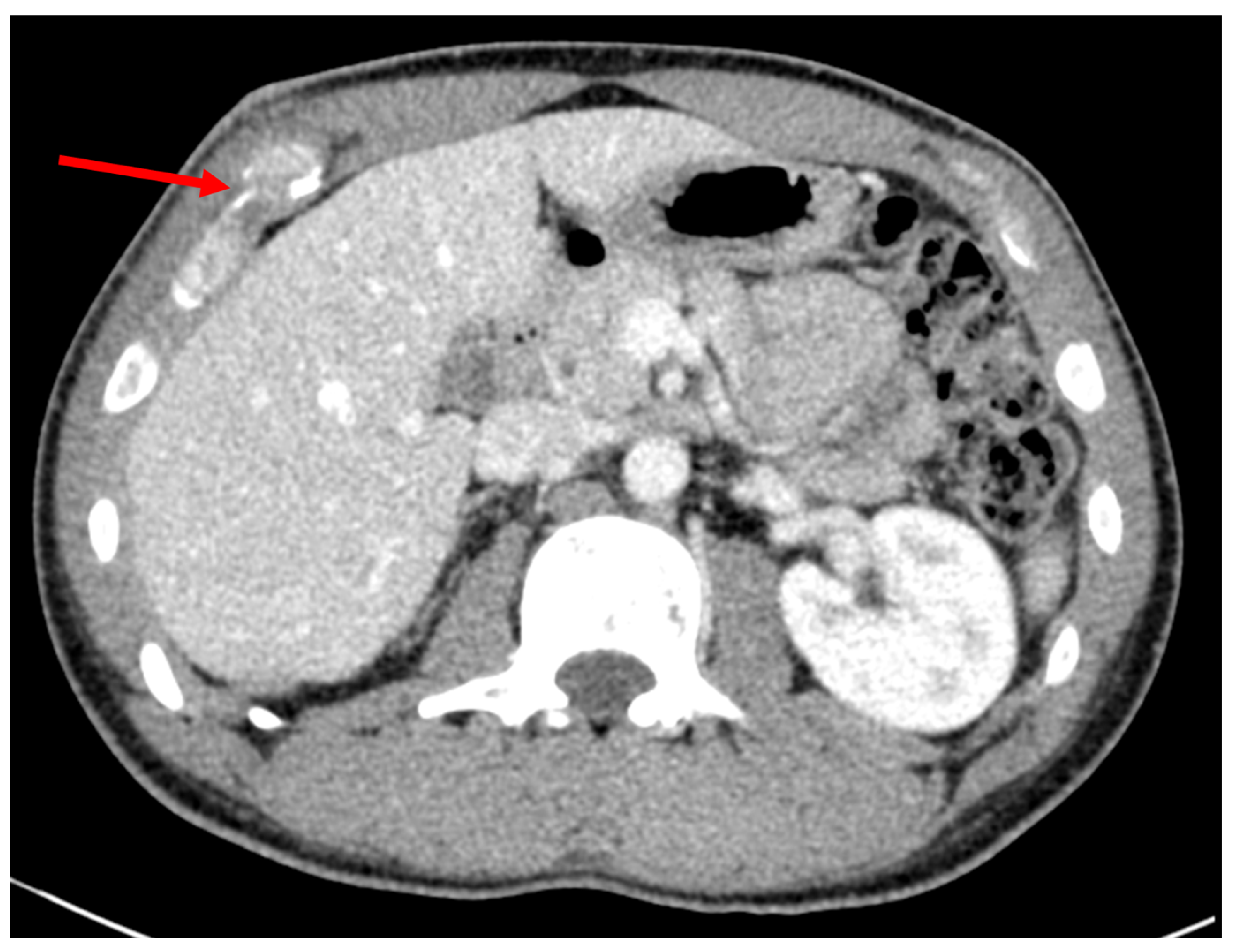 Surgeries 06 00032 g001