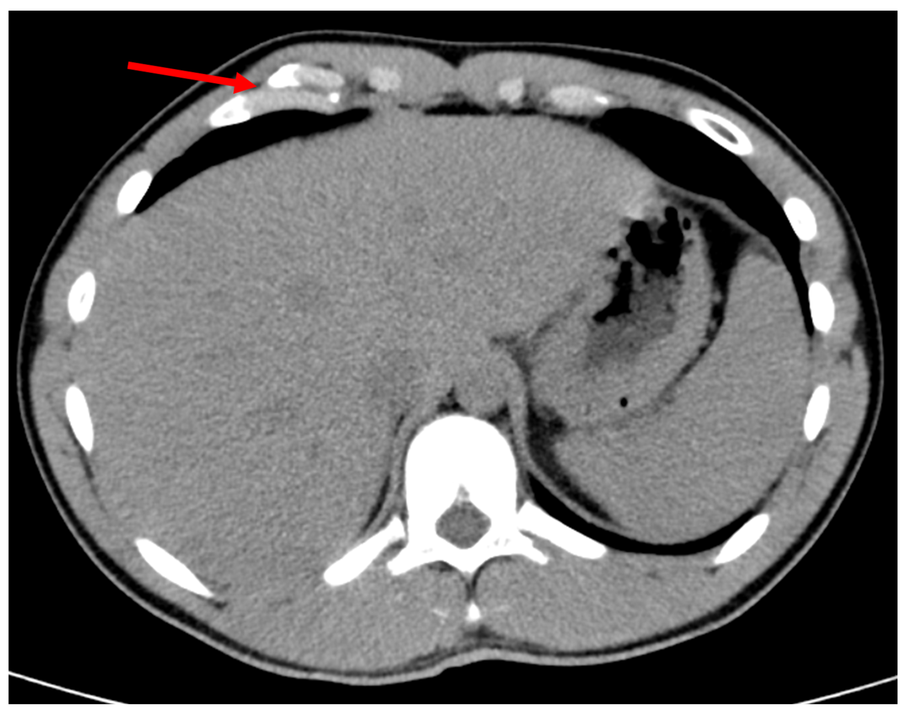 Surgeries 06 00032 g002