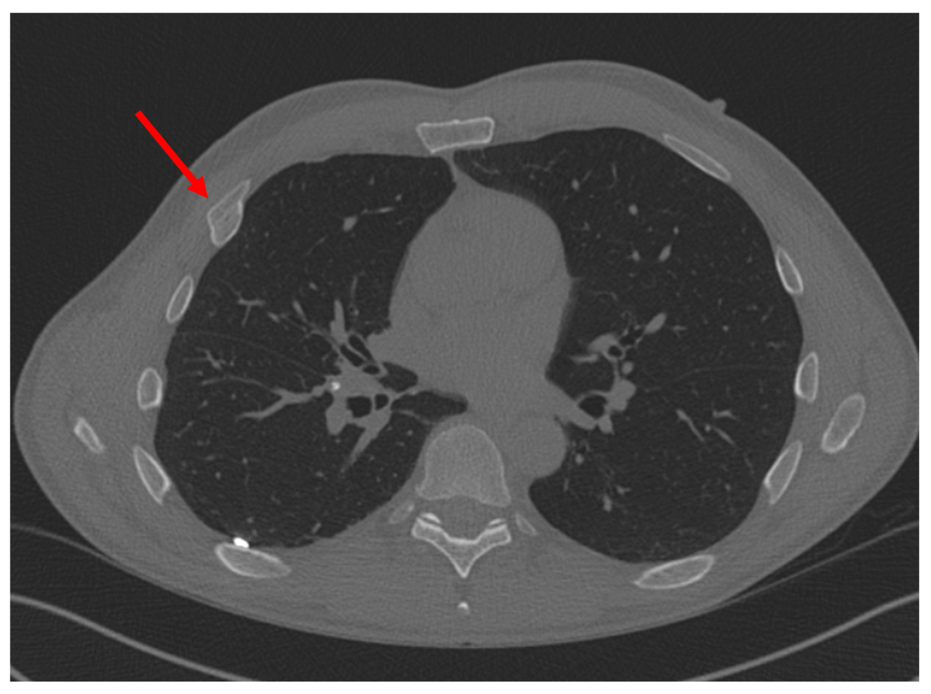 Surgeries 06 00032 g003