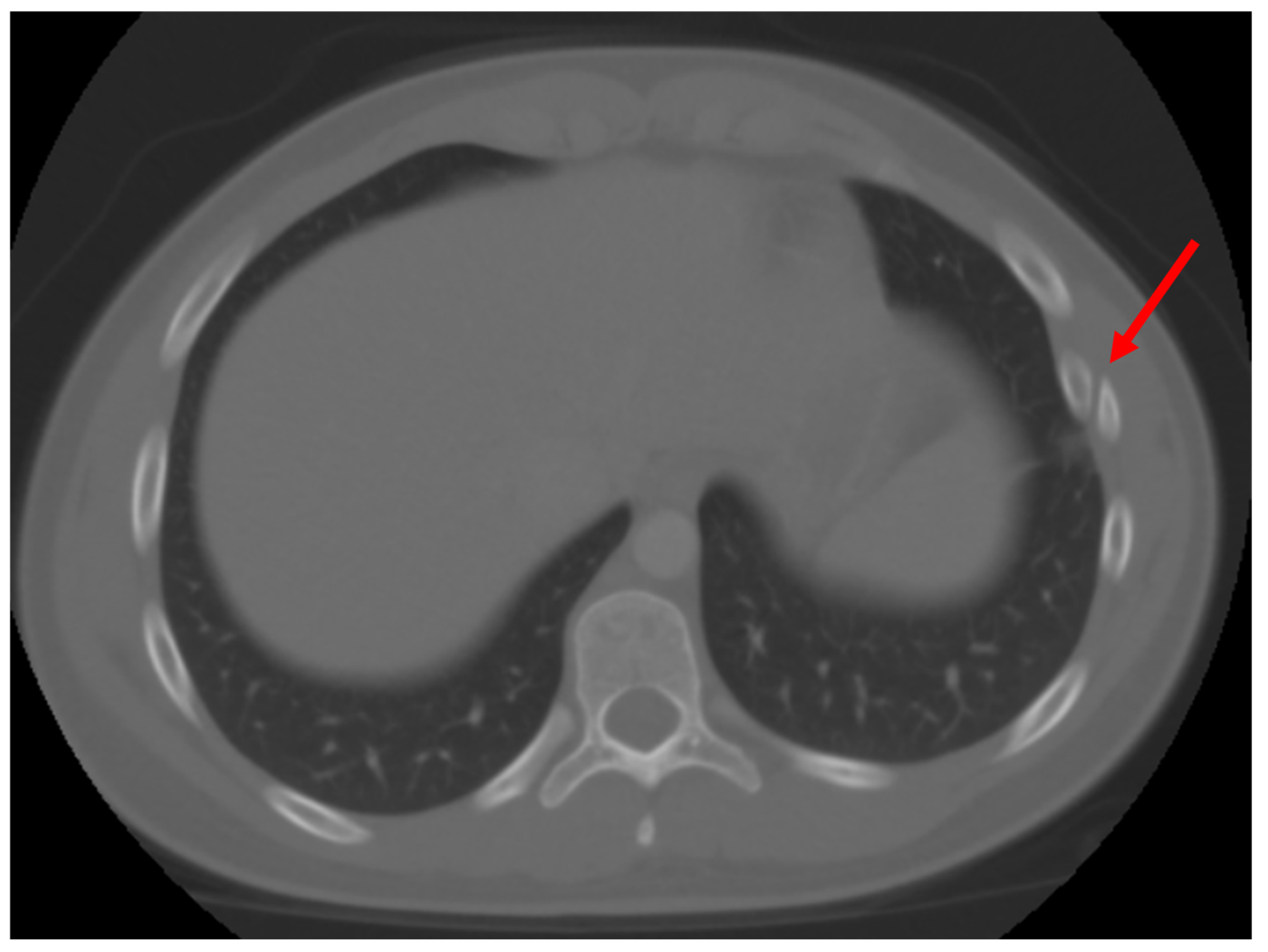 Surgeries 06 00032 g004