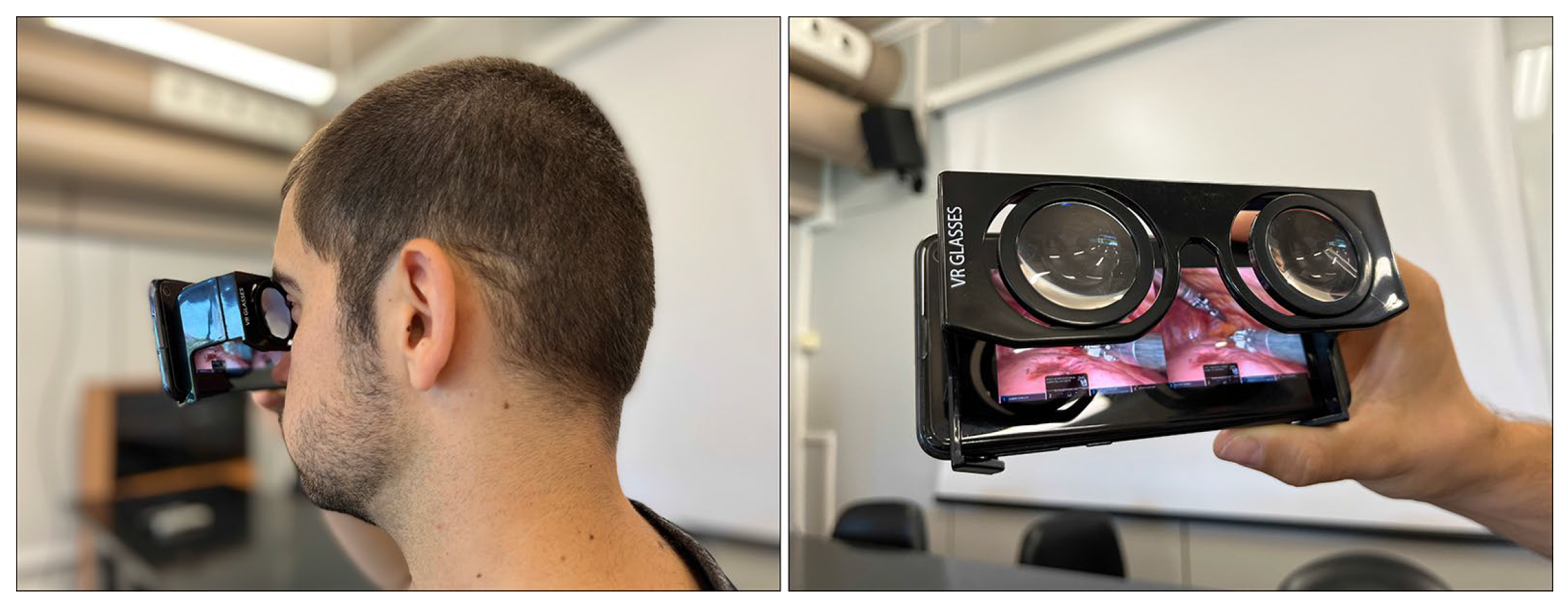 Surgeries 06 00035 g002