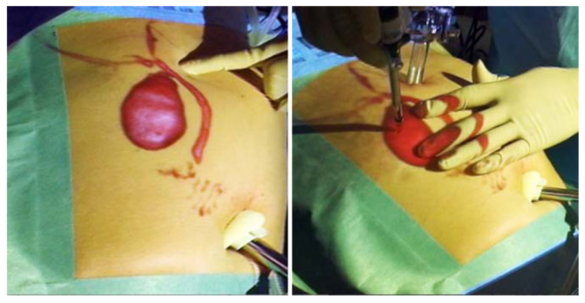 Surgeries 06 00035 g004