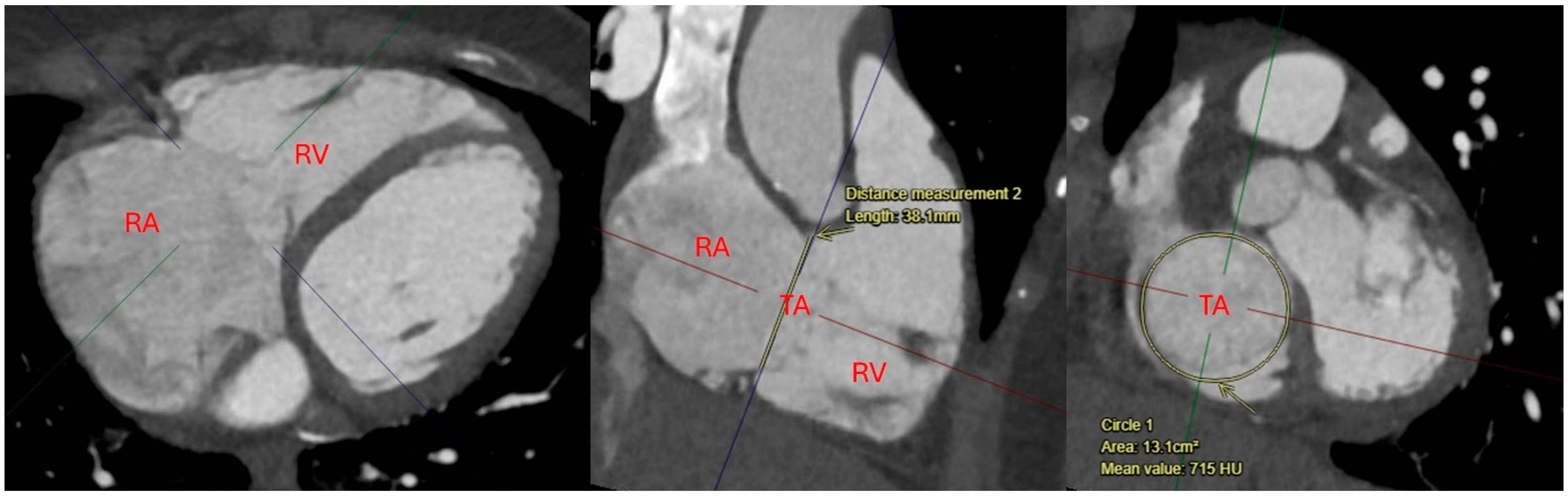 Surgeries 06 00039 g003 Surgeries 06 00039 g003
