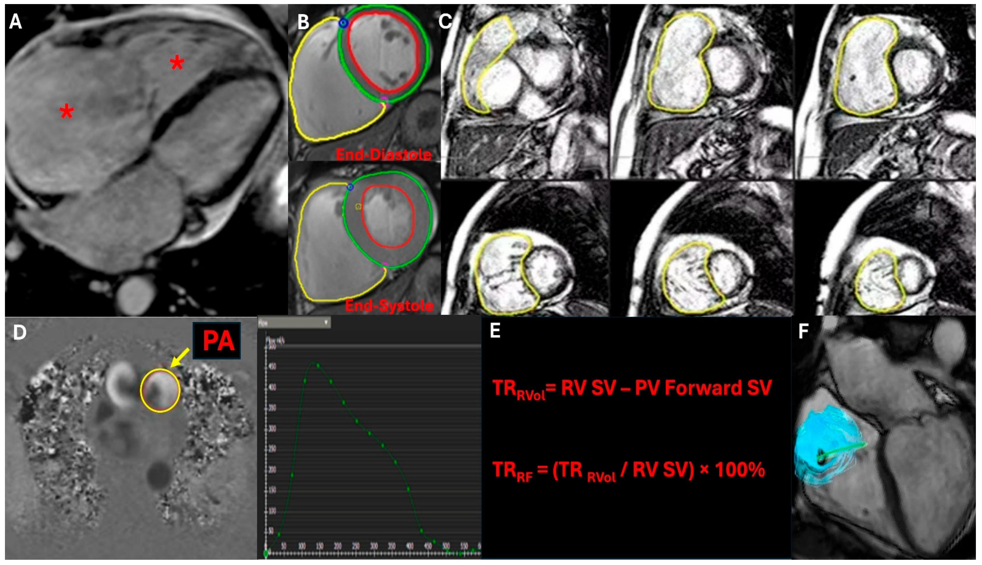 Surgeries 06 00039 g004 Surgeries 06 00039 g004