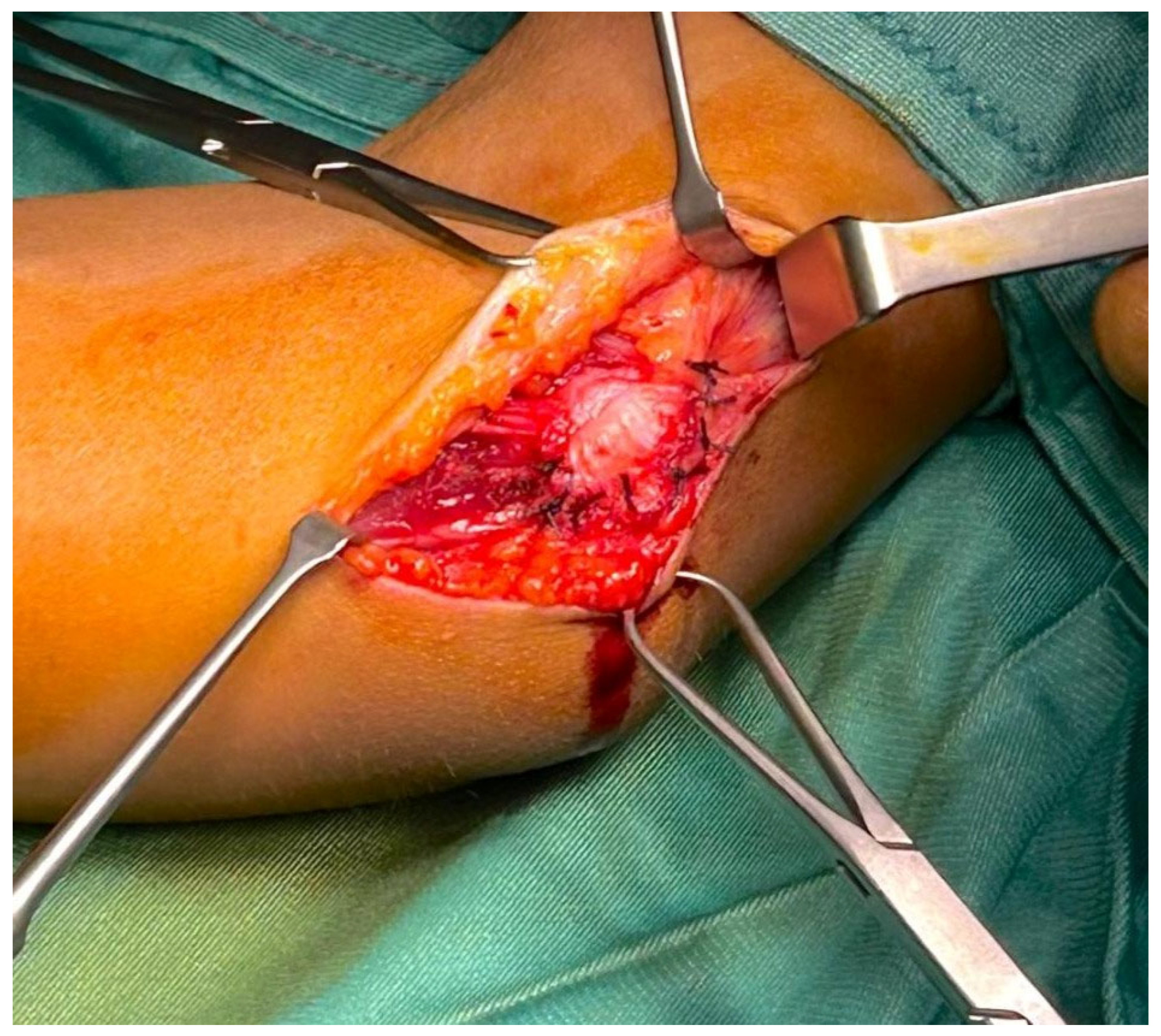 Surgeries 06 00049 g003