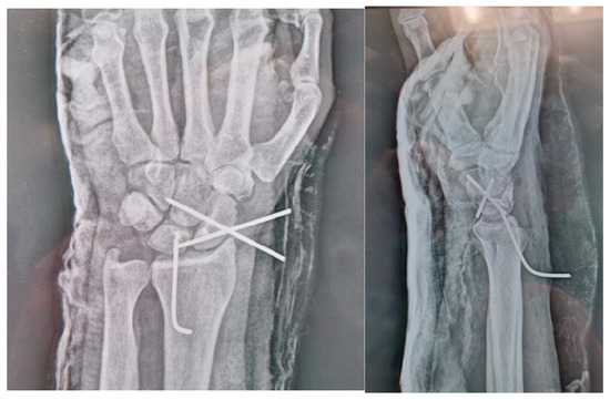 Surgeries 06 00057 g010