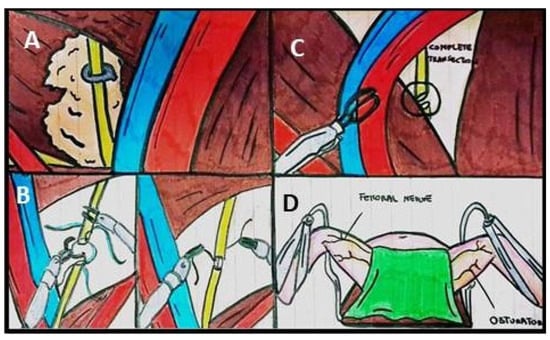 Surgeries 06 00058 g001