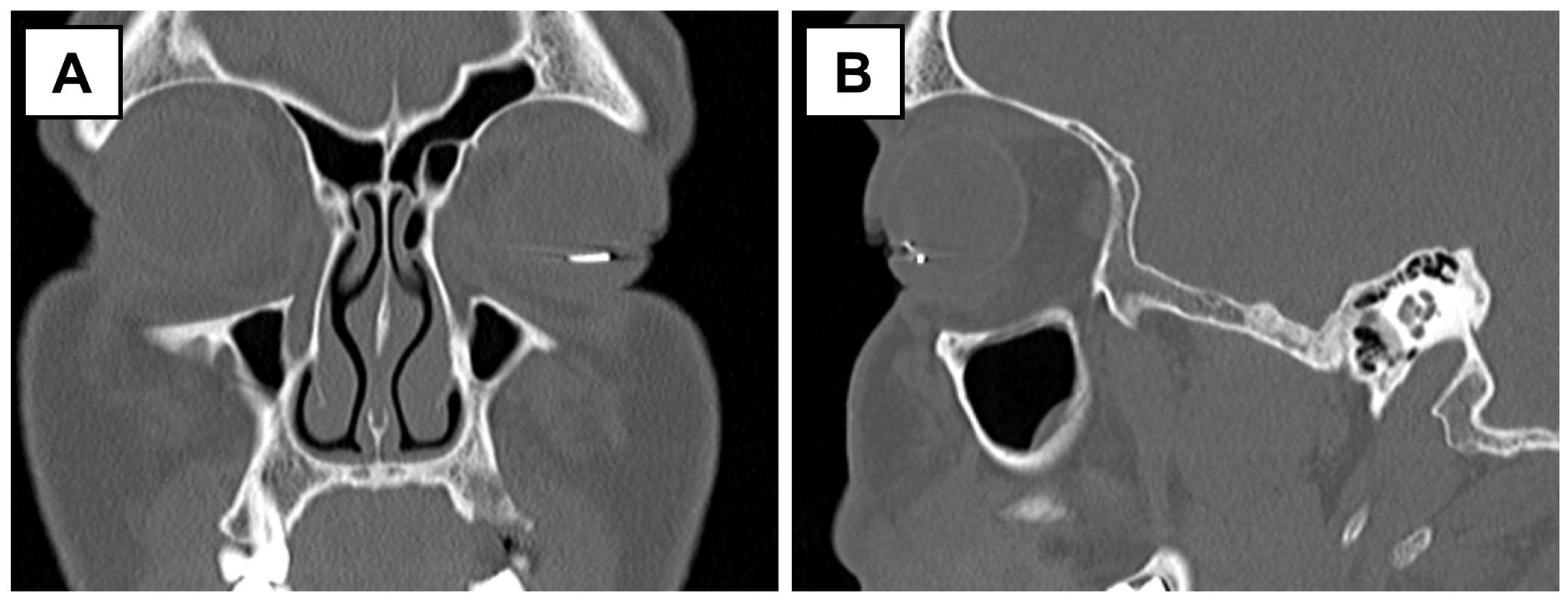 Surgeries 06 00068 g002