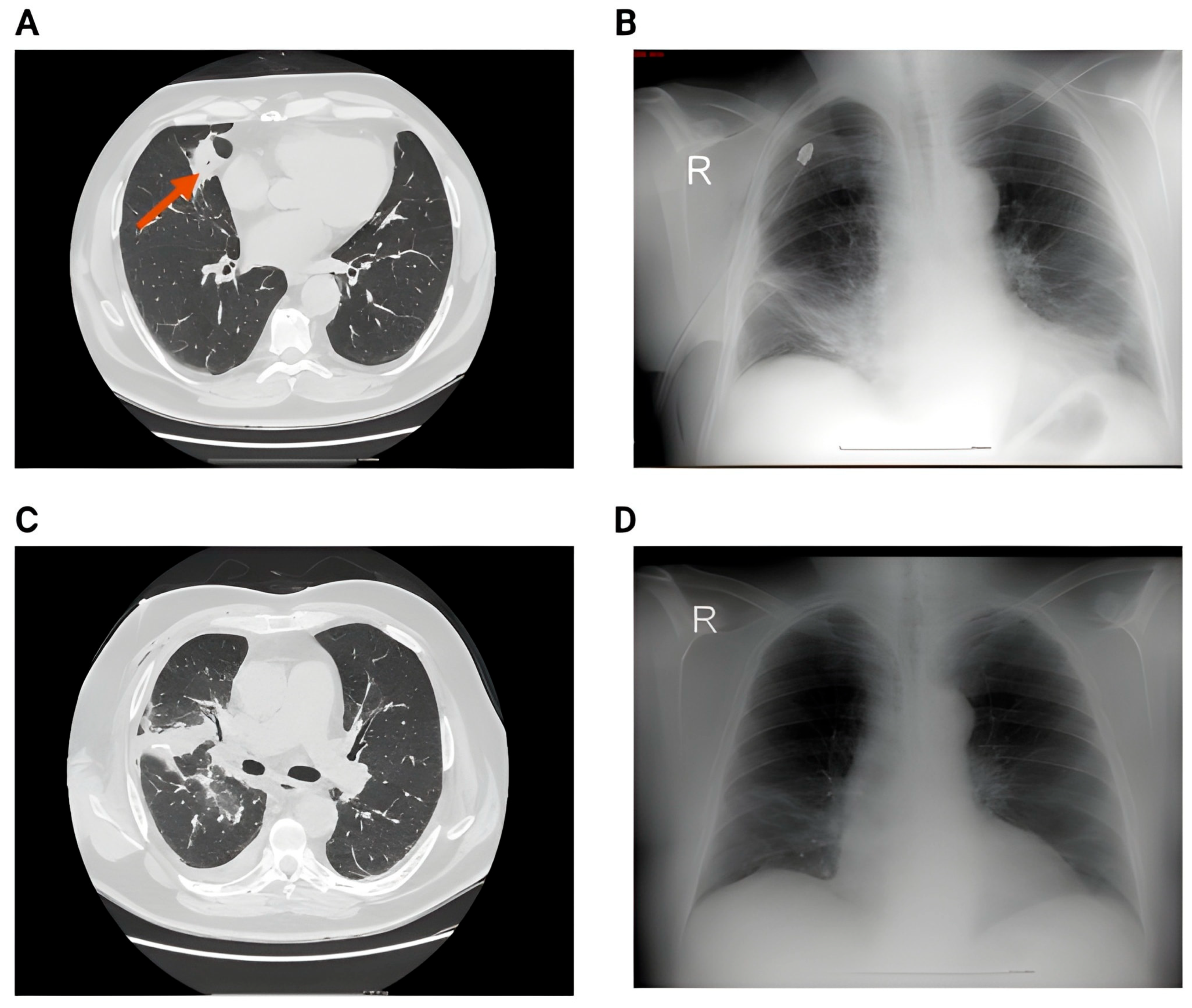 Surgeries 06 00084 g005