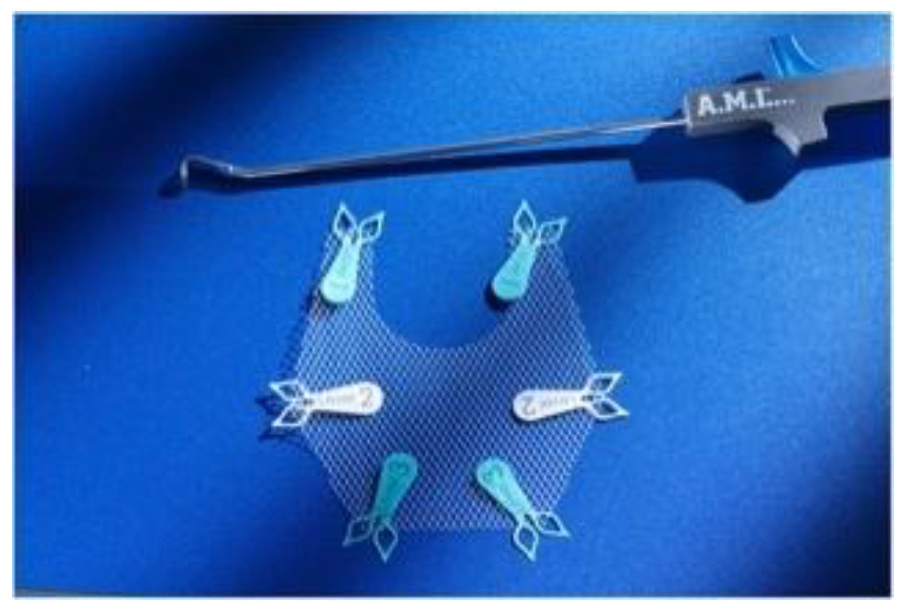 Surgeries 06 00089 g001