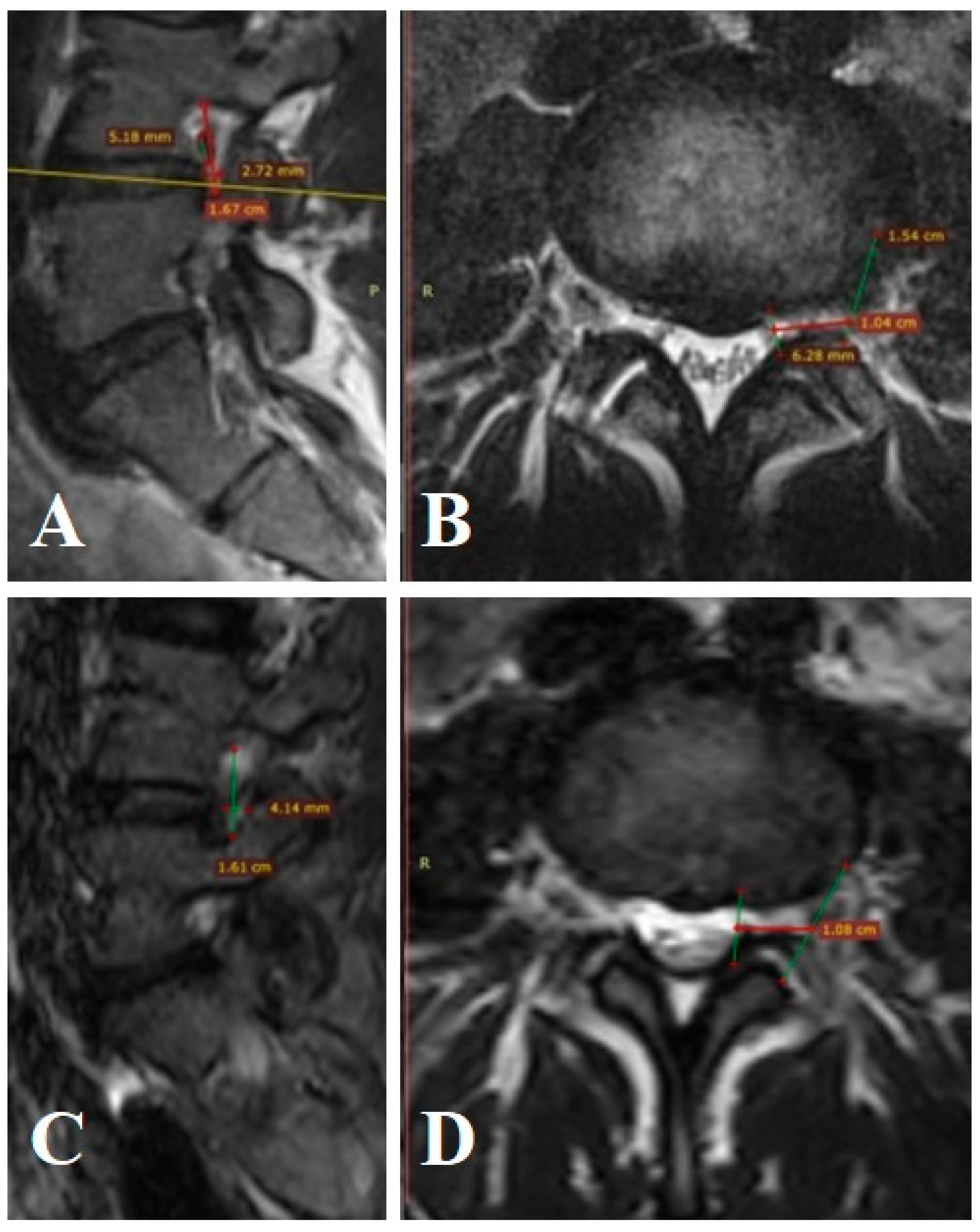 Surgeries 06 00091 g0a1