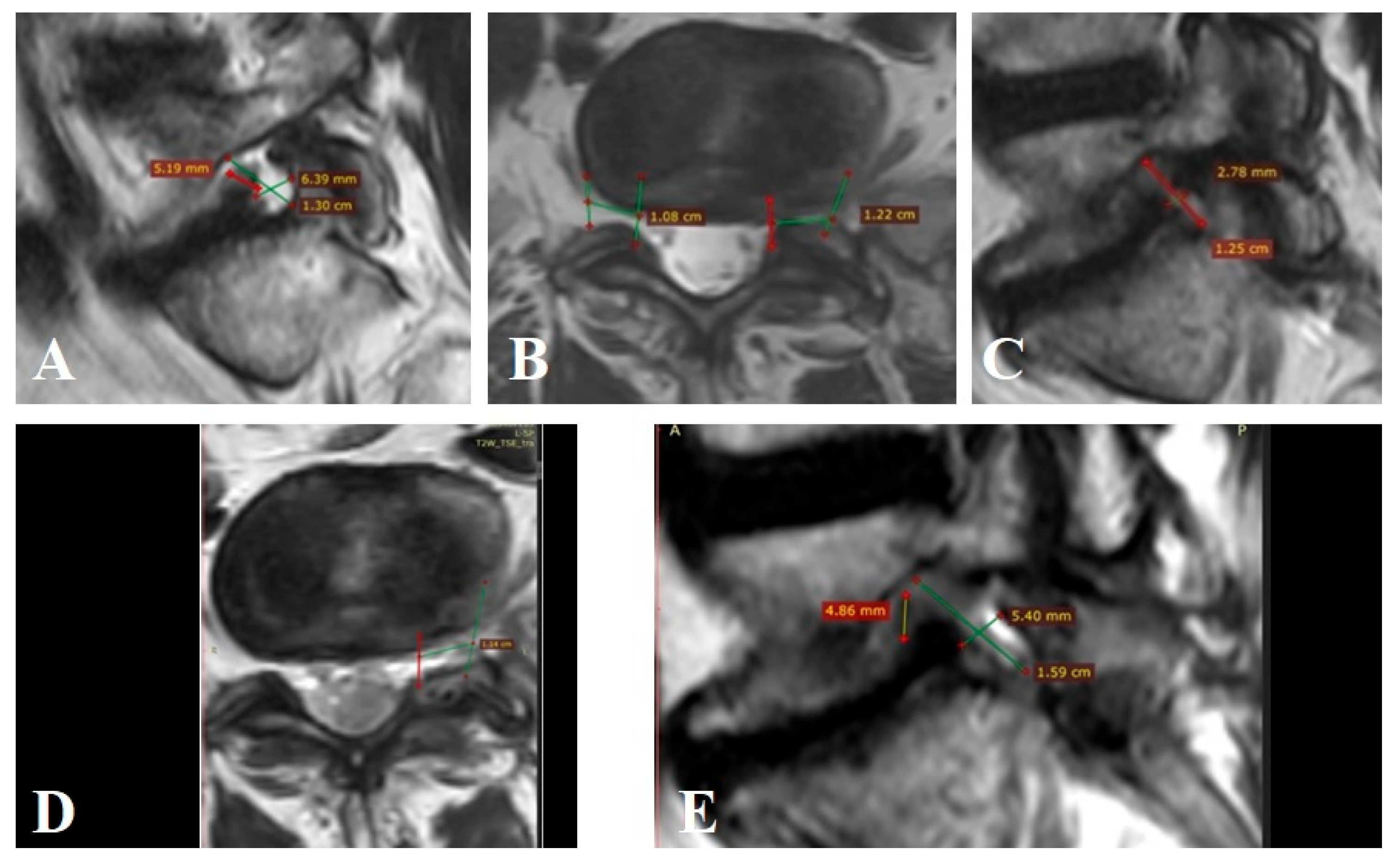 Surgeries 06 00091 g0a4