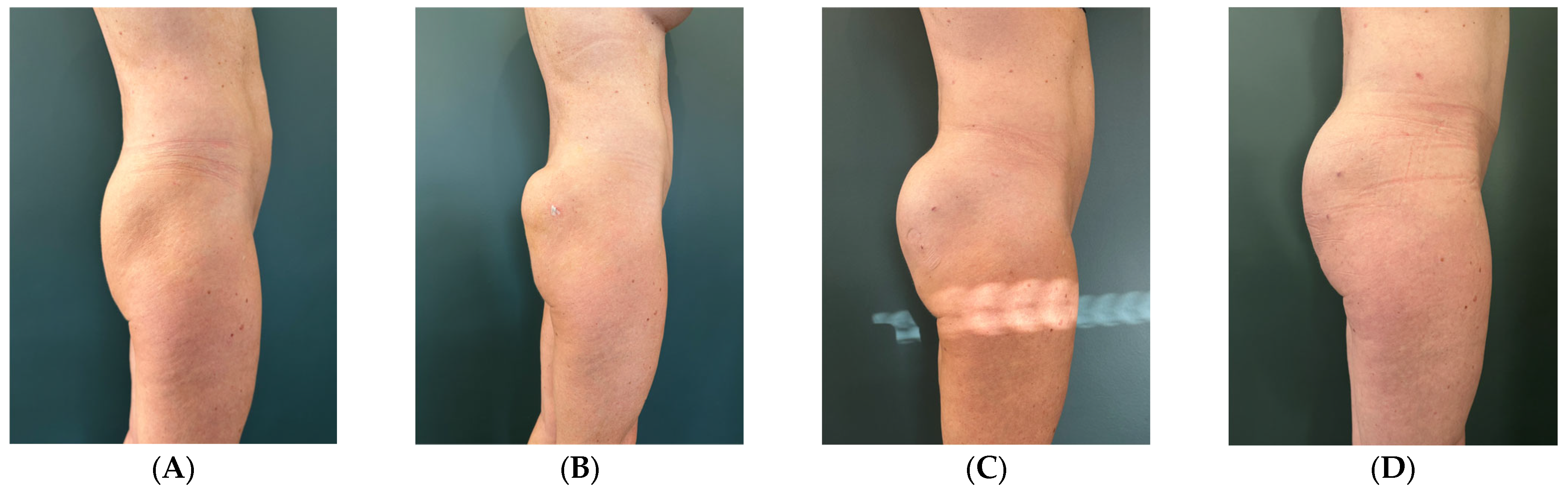 Surgeries 07 00003 g001