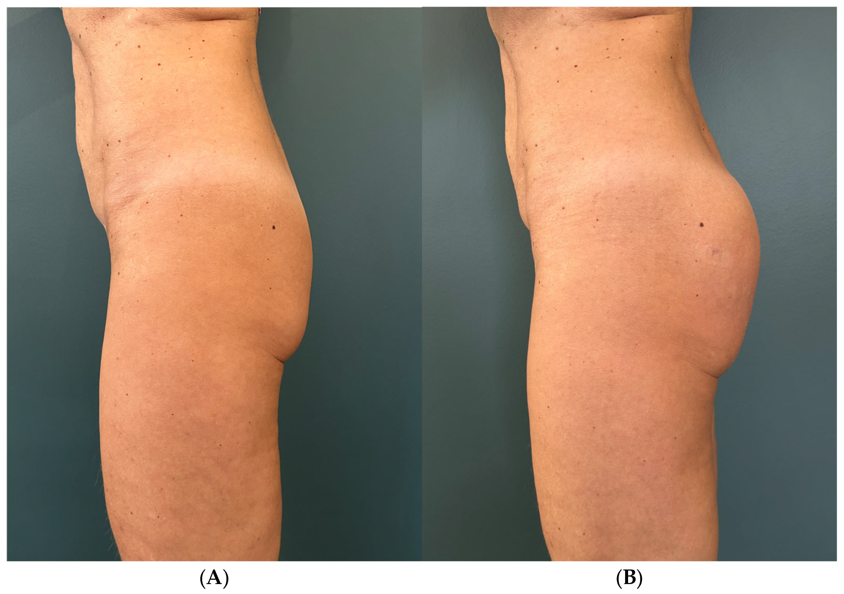 Surgeries 07 00003 g002