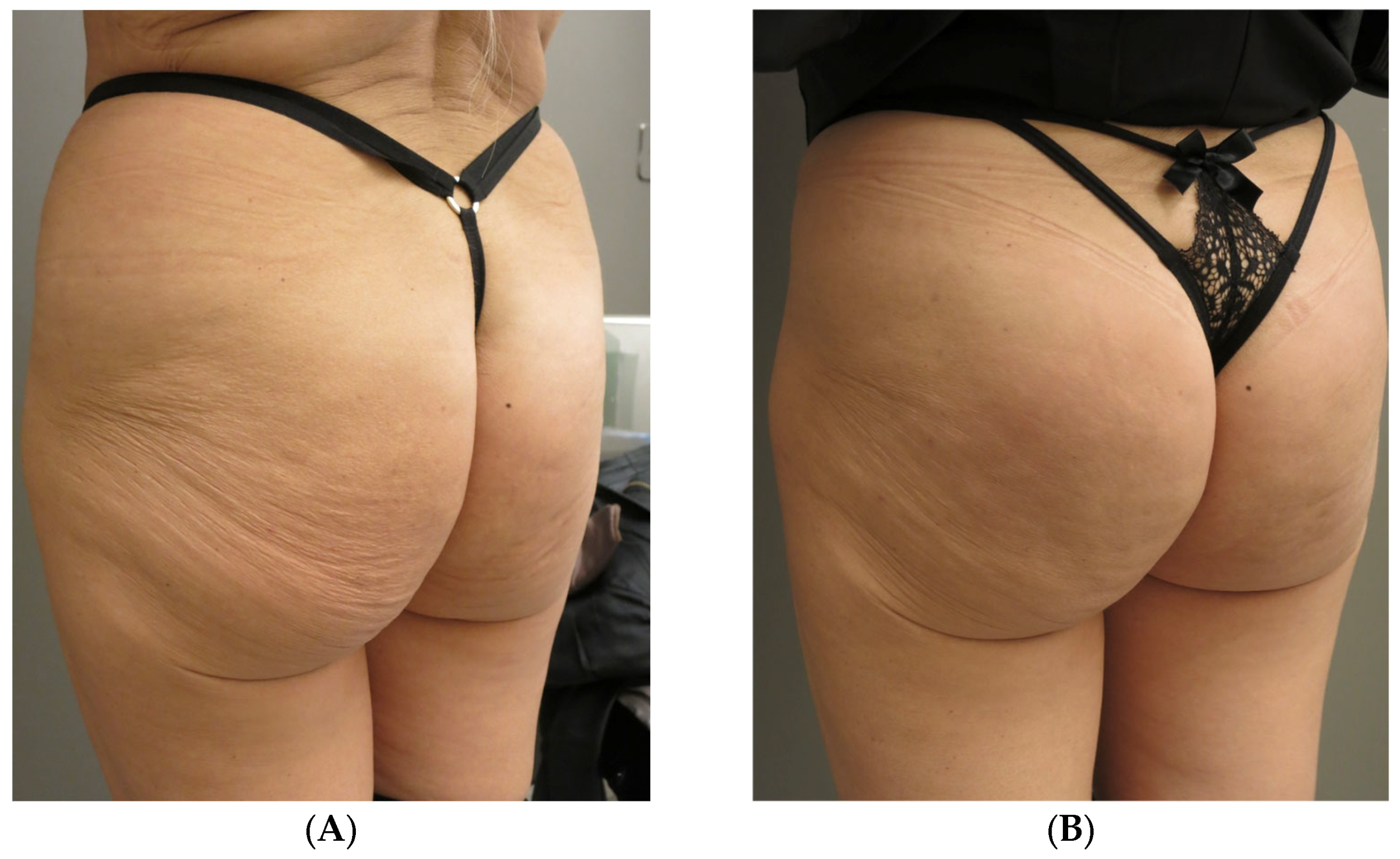 Surgeries 07 00003 g003