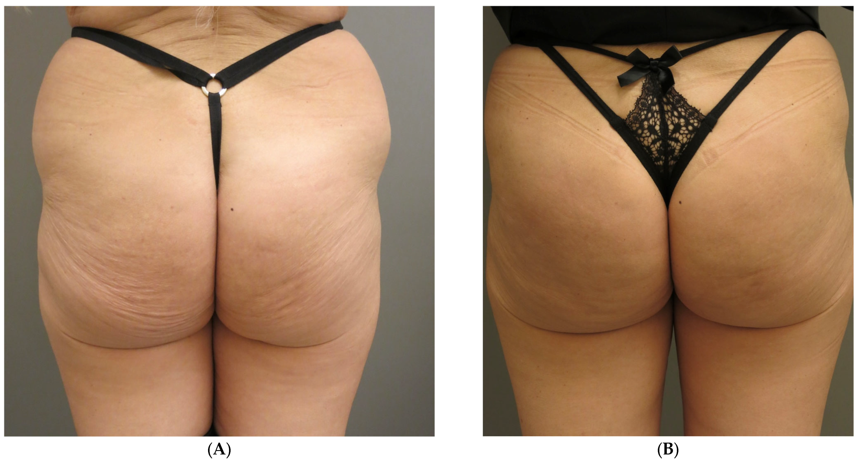 Surgeries 07 00003 g004