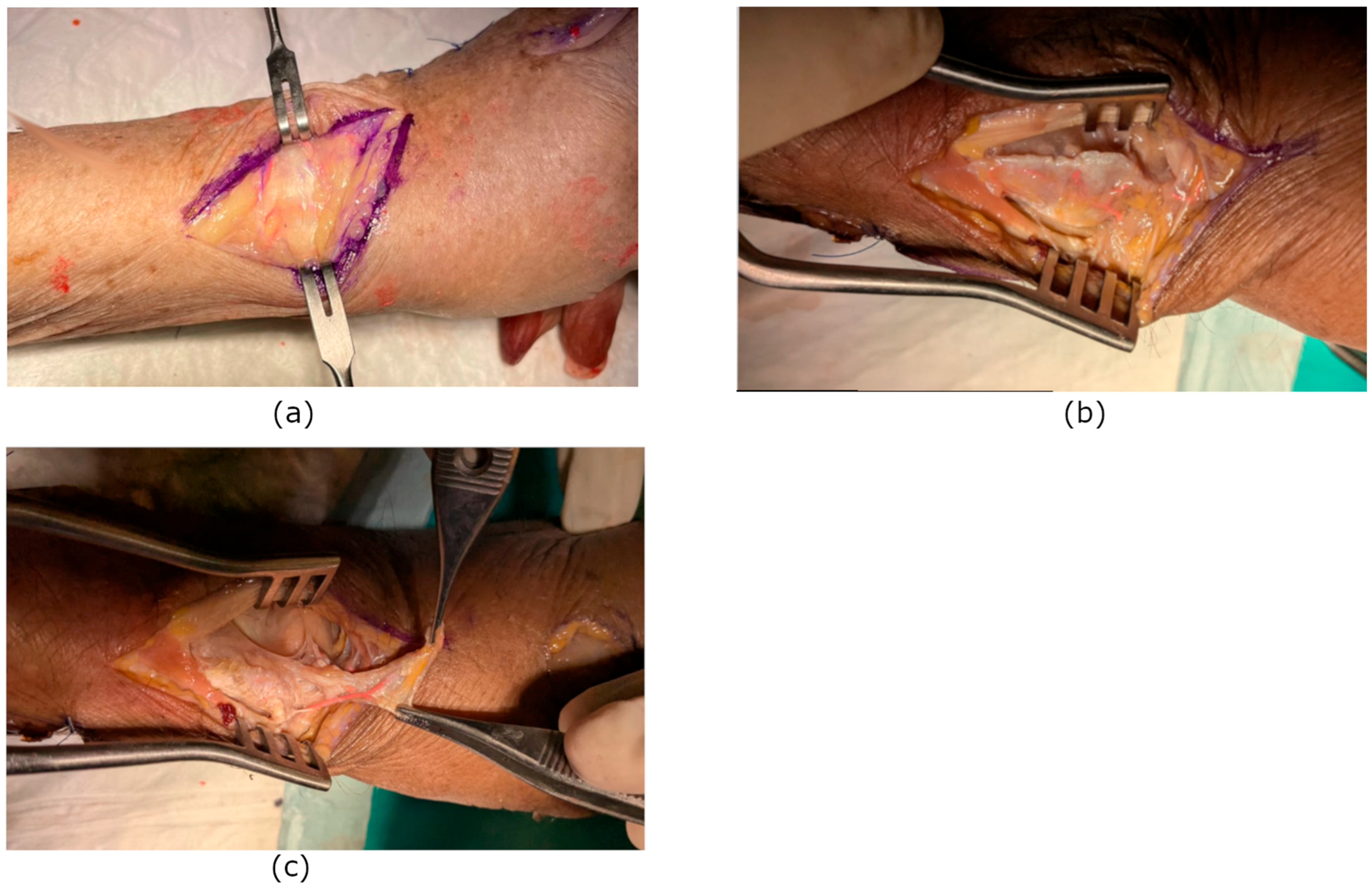 Surgeries 07 00008 g001