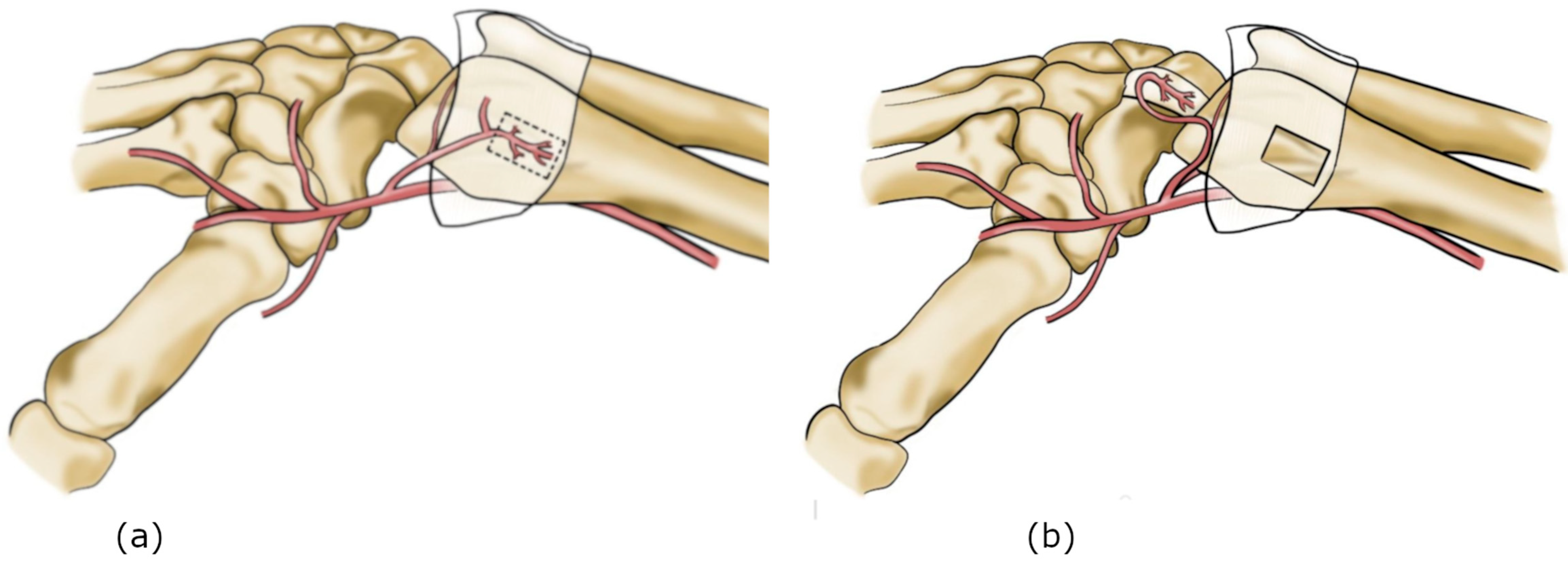Surgeries 07 00008 g002