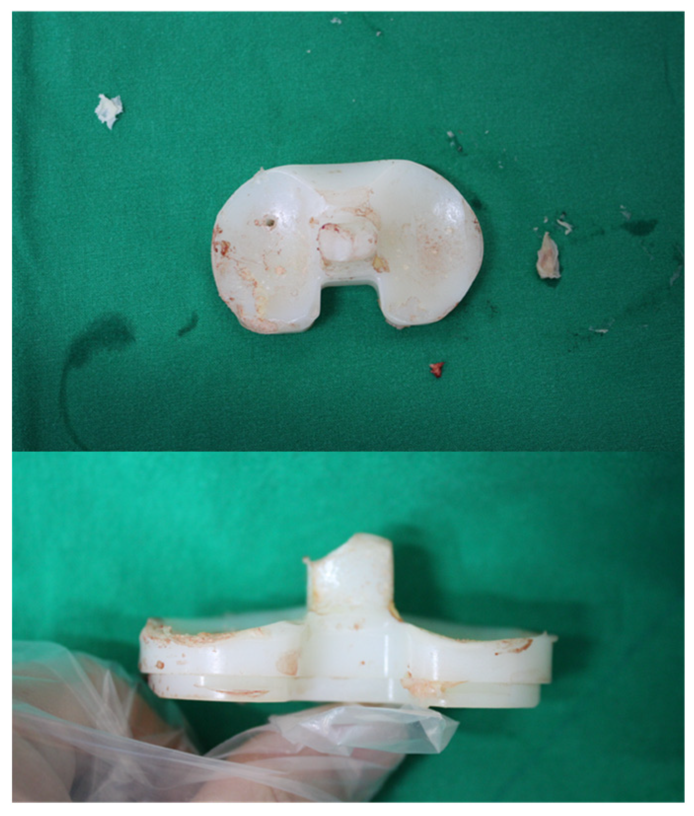 Surgeries 07 00012 g003 Surgeries 07 00012 g003